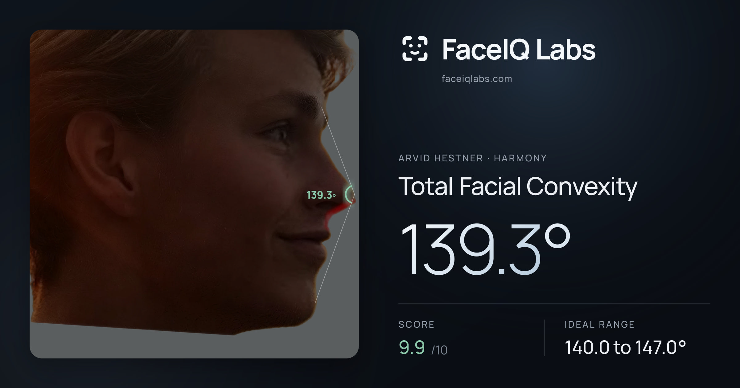 Arvid Hestner Total Facial Convexity: 139.3°, drawn on the photo