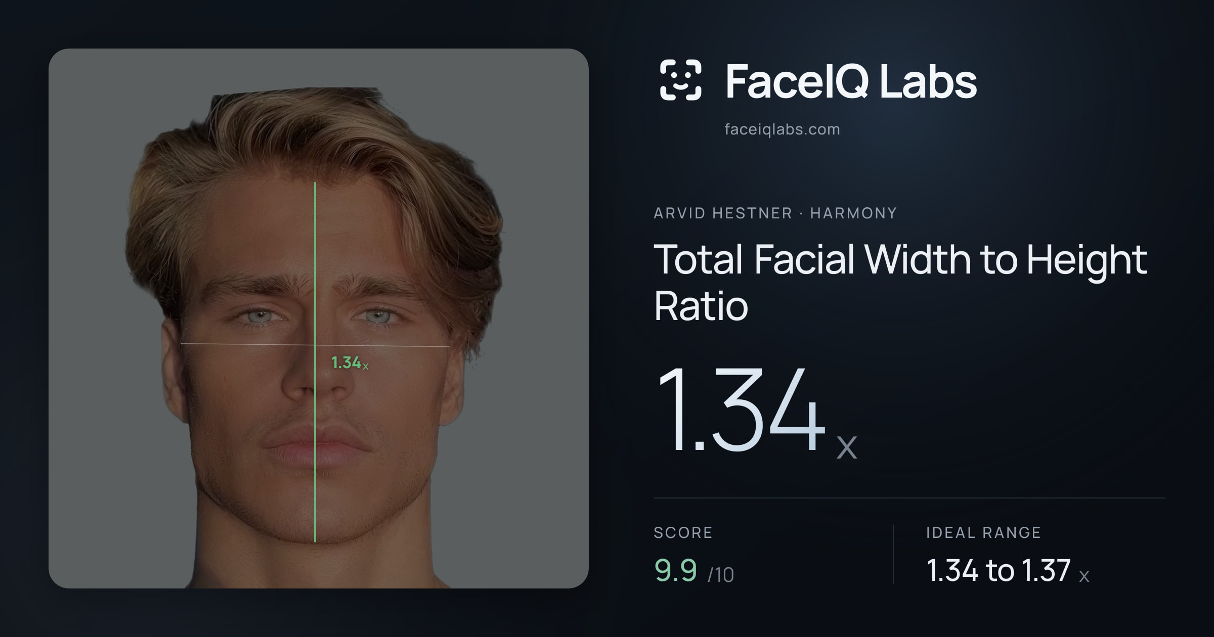 Arvid Hestner Total Facial Width to Height Ratio: 1.34x, drawn on the photo