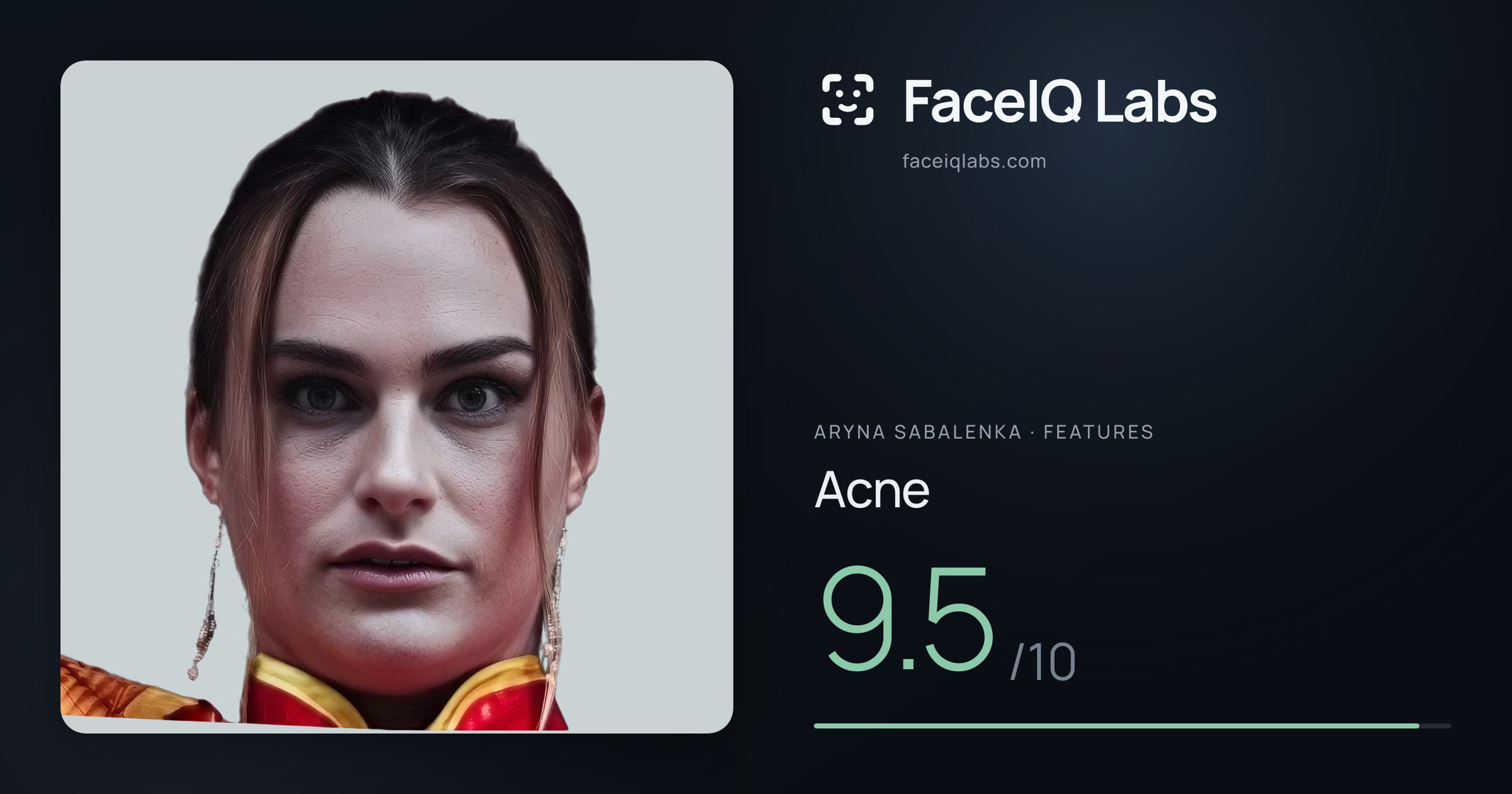 Aryna Sabalenka Acne: 9.5/10, drawn on the photo