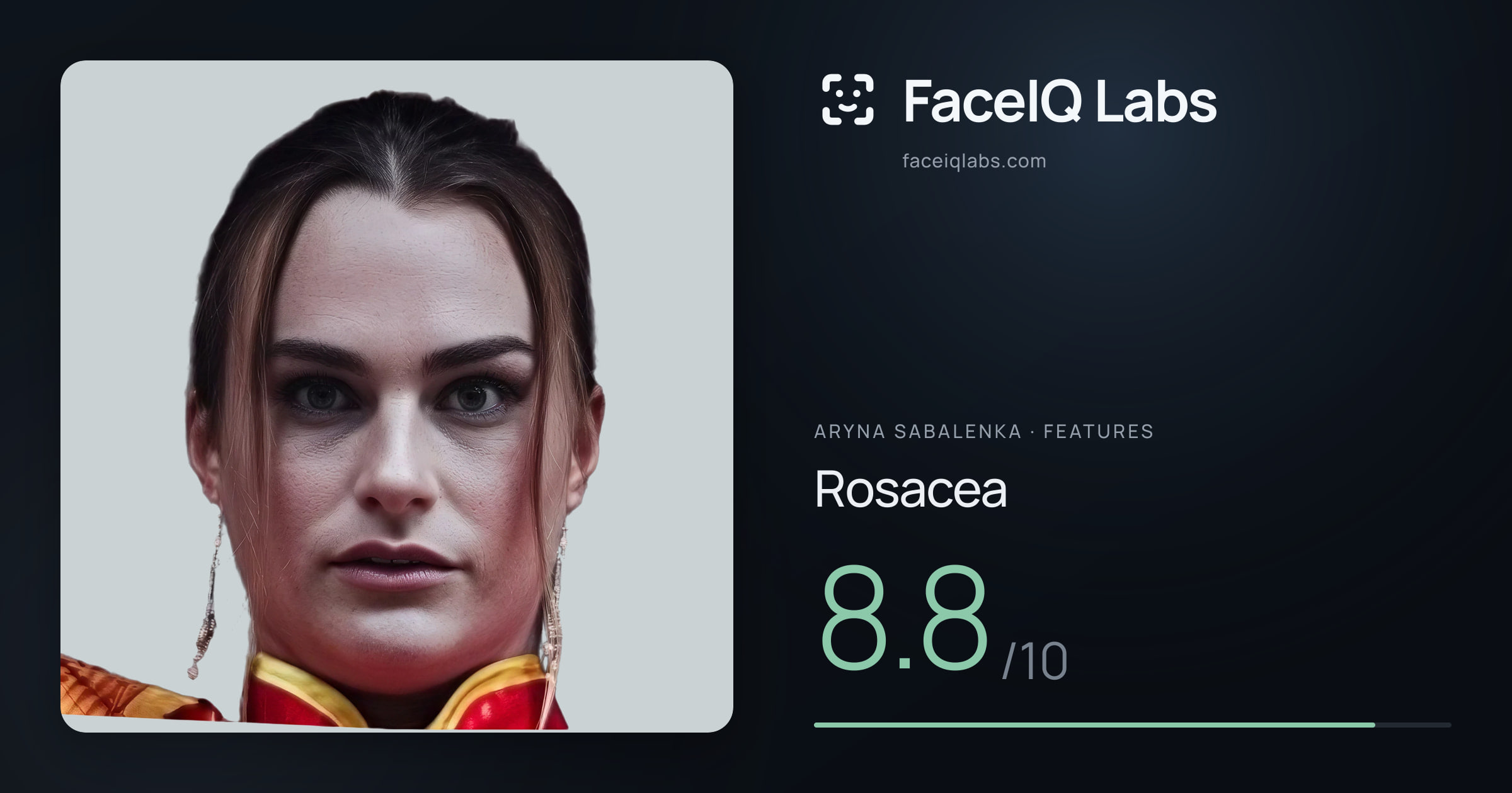 Aryna Sabalenka Rosacea: 8.8/10, drawn on the photo