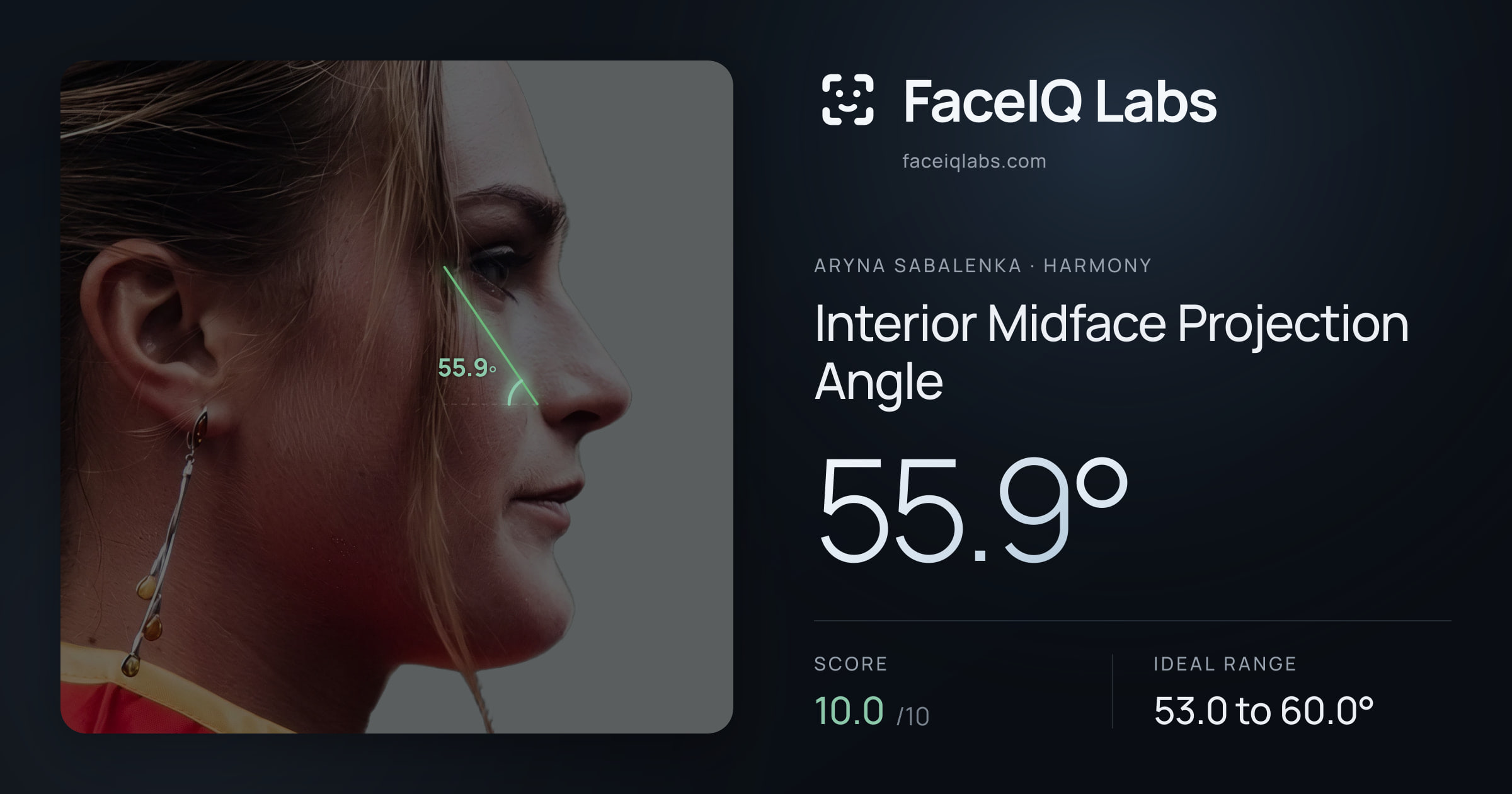 Aryna Sabalenka Interior Midface Projection Angle: 55.9°, drawn on the photo