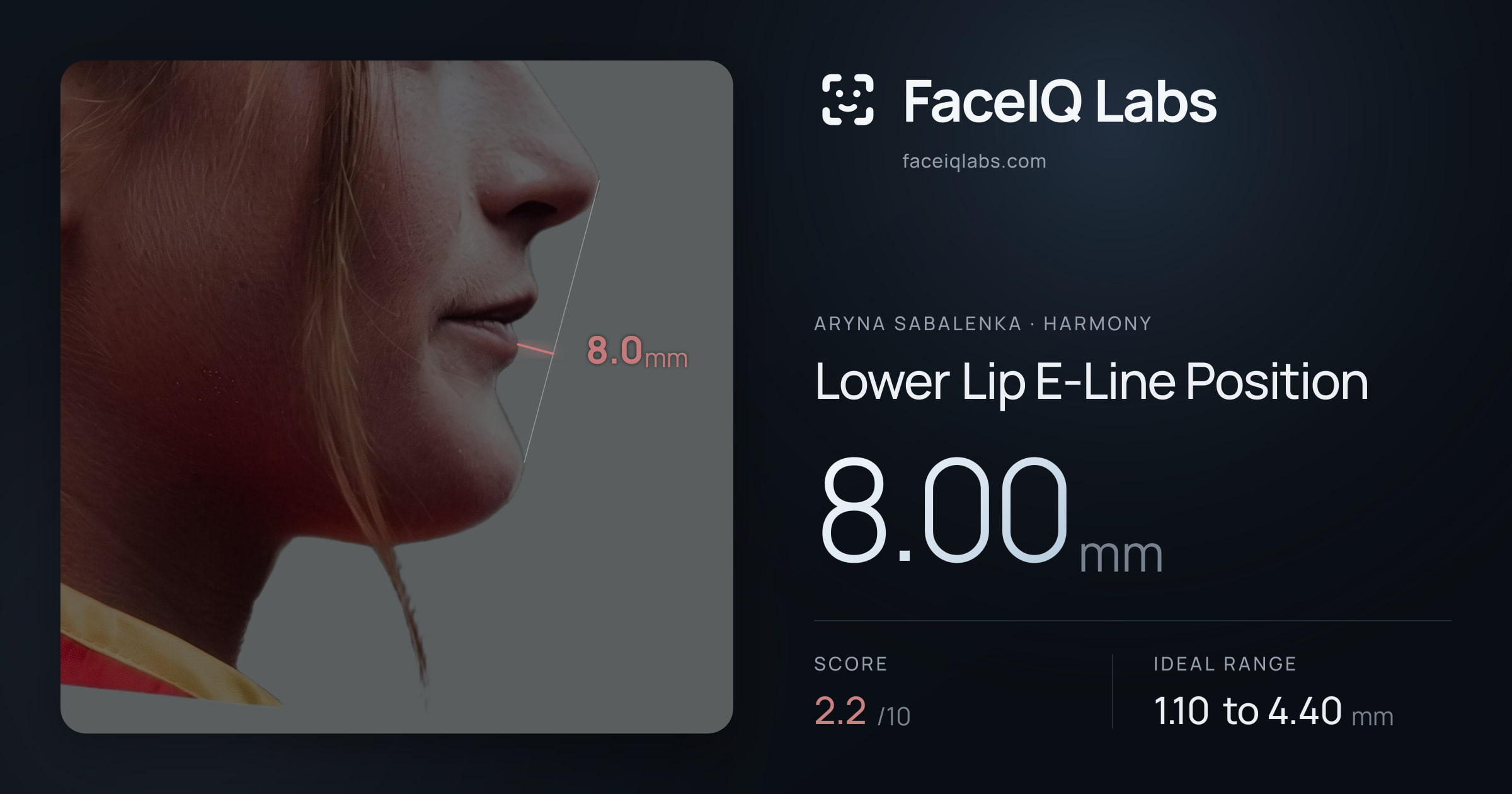 Aryna Sabalenka Lower Lip E-Line Position: 8.00mm, drawn on the photo