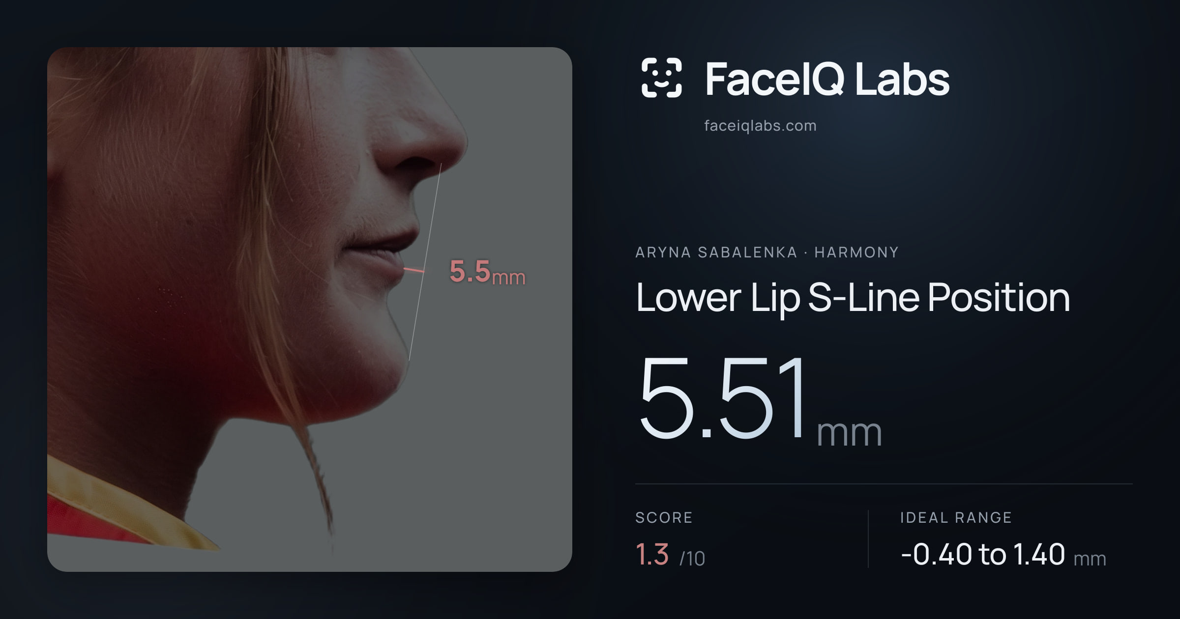 Aryna Sabalenka Lower Lip S-Line Position: 5.51mm, drawn on the photo