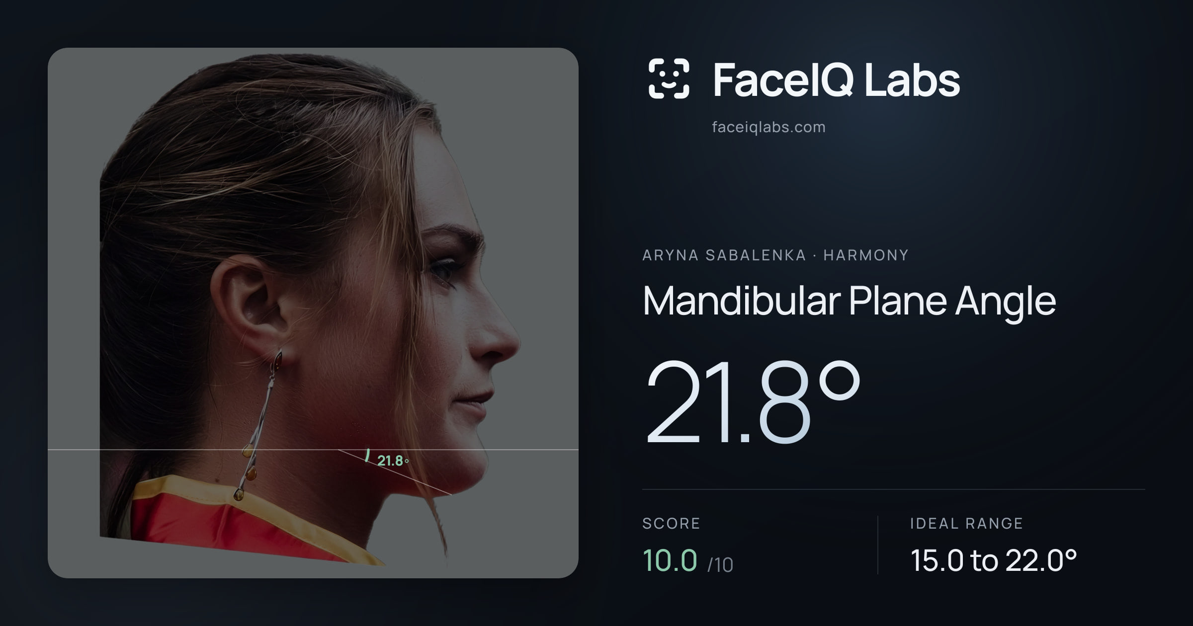 Aryna Sabalenka Mandibular Plane Angle: 21.8°, drawn on the photo