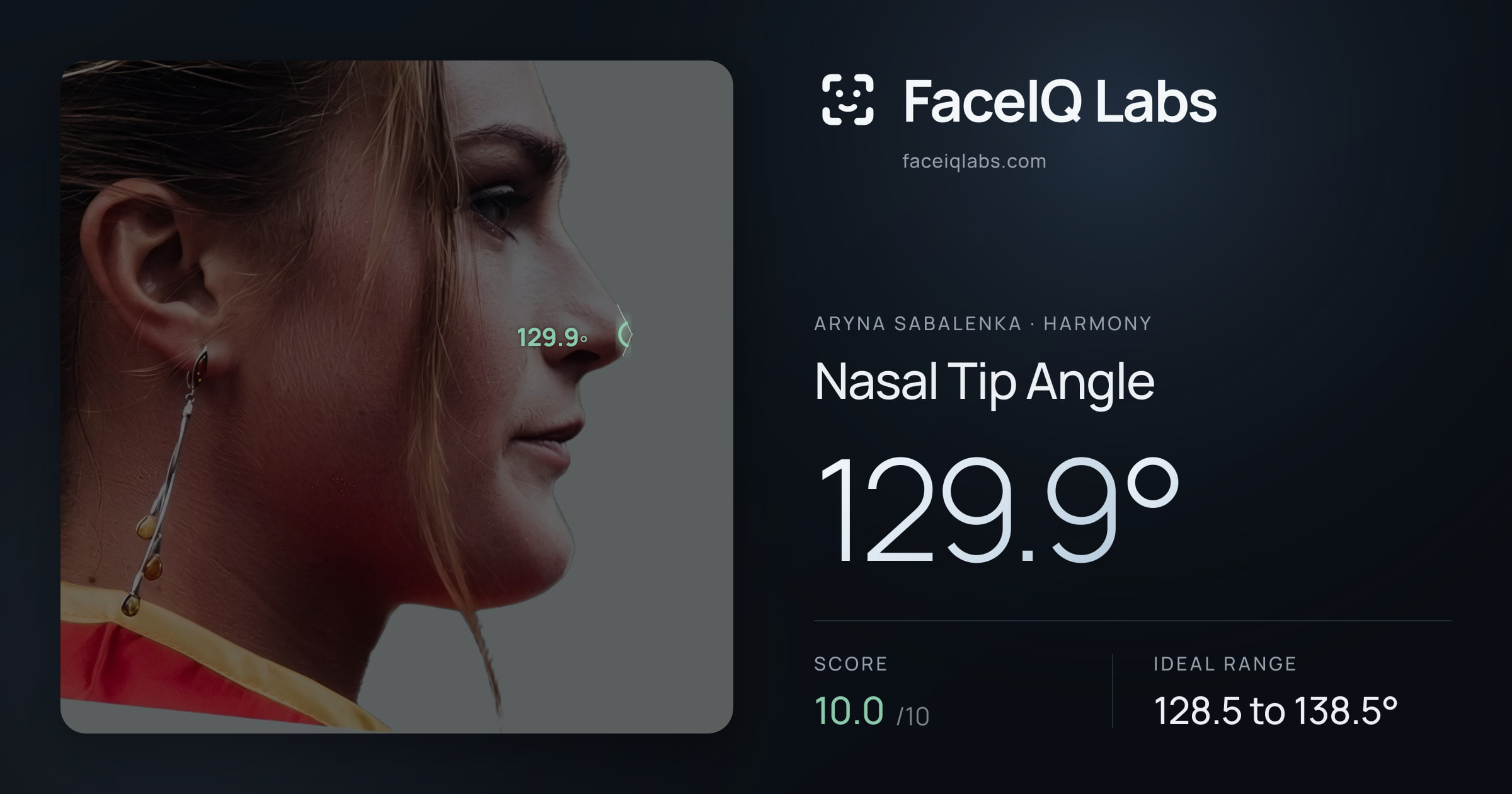 Aryna Sabalenka Nasal Tip Angle: 129.9°, drawn on the photo
