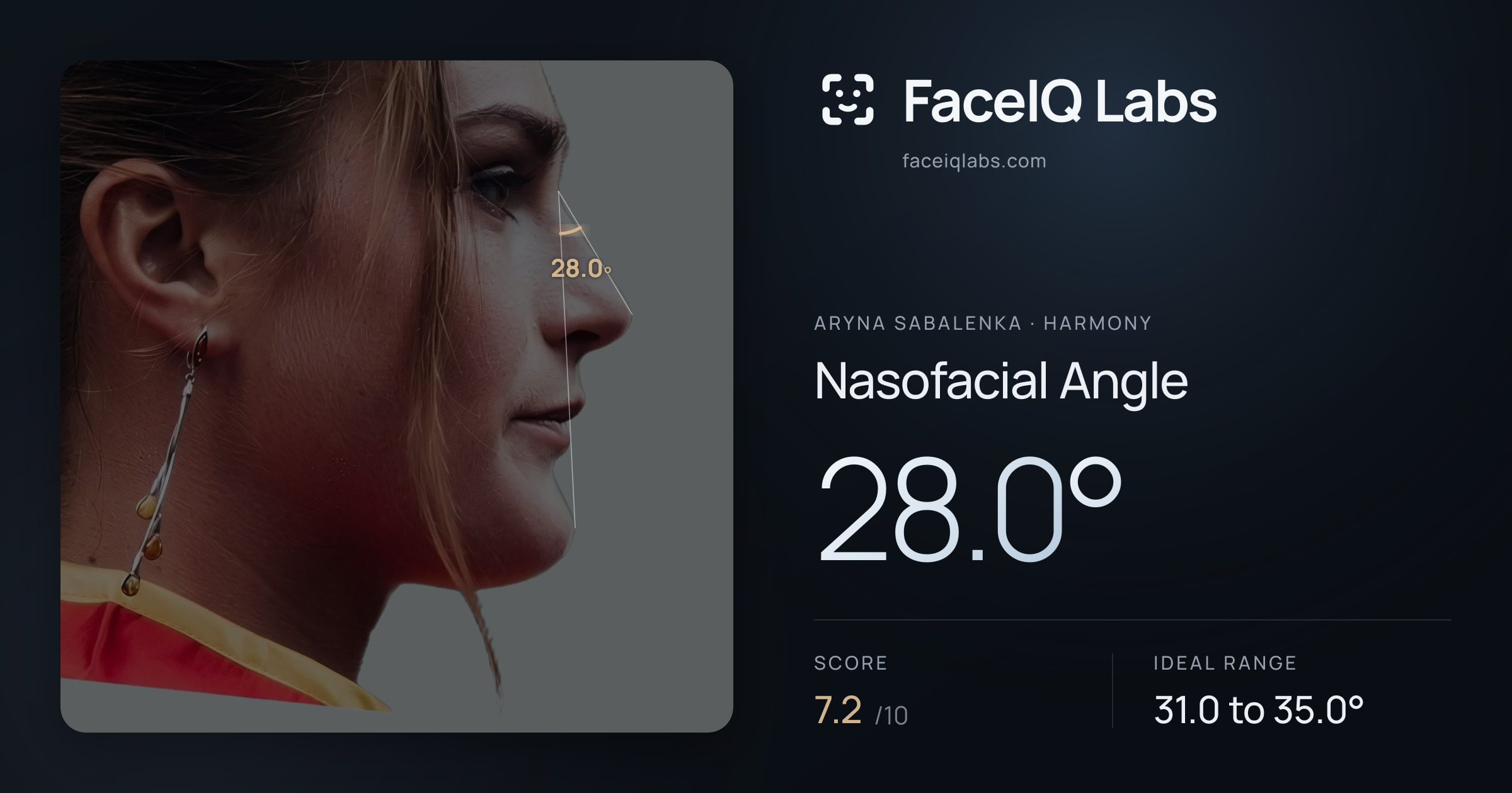 Aryna Sabalenka Nasofacial Angle: 28.0°, drawn on the photo