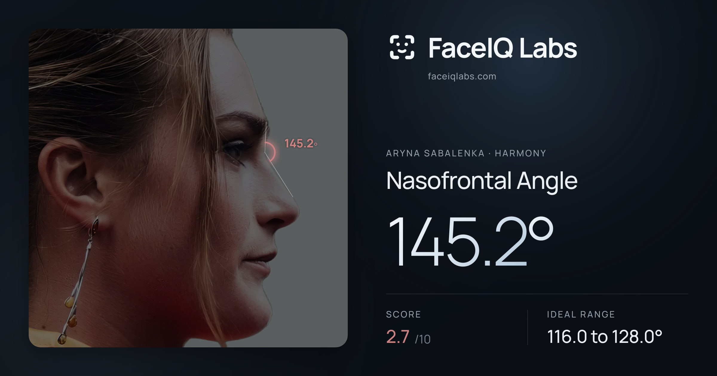 Aryna Sabalenka Nasofrontal Angle: 145.2°, drawn on the photo
