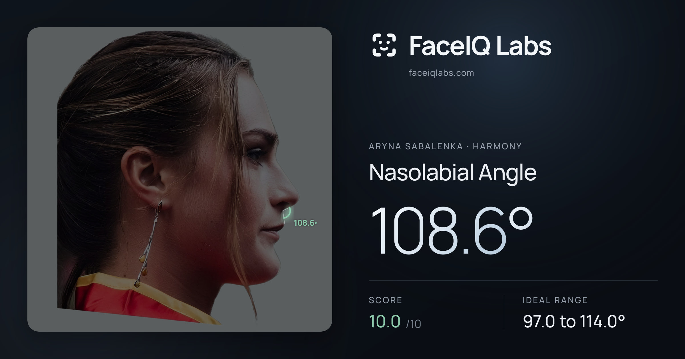 Aryna Sabalenka Nasolabial Angle: 108.6°, drawn on the photo