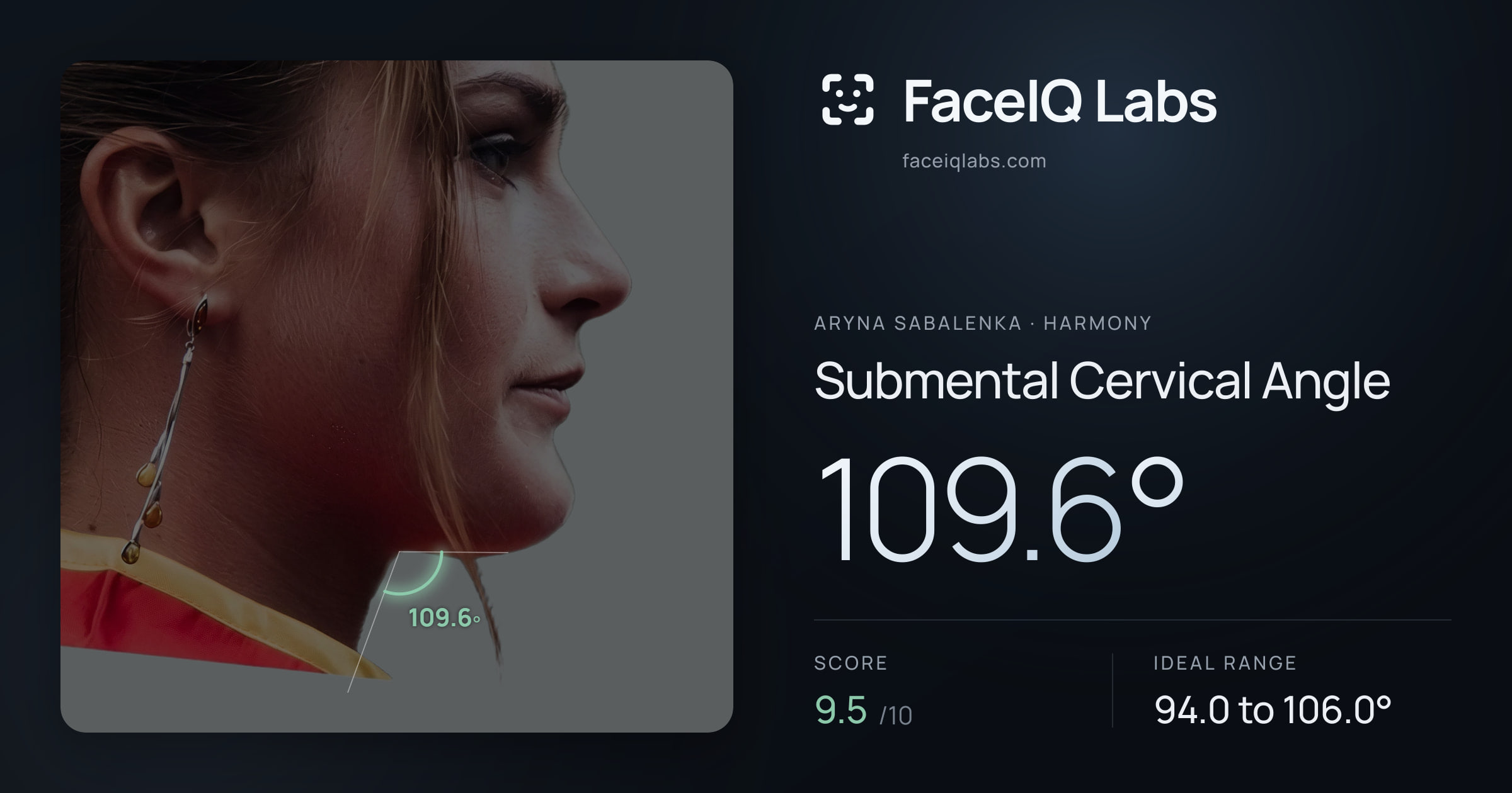 Aryna Sabalenka Submental Cervical Angle: 109.6°, drawn on the photo