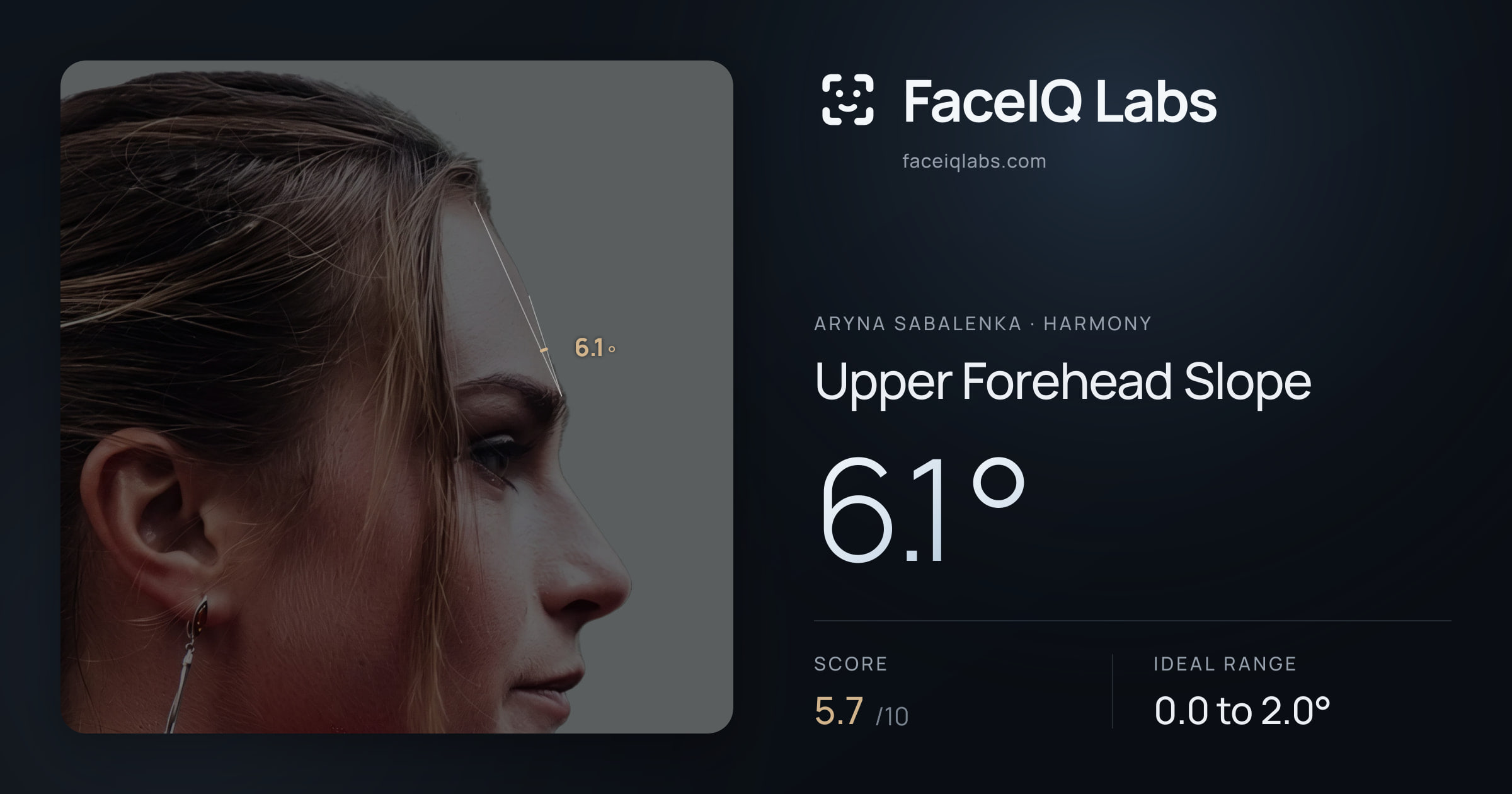 Aryna Sabalenka Upper Forehead Slope: 6.1°, drawn on the photo