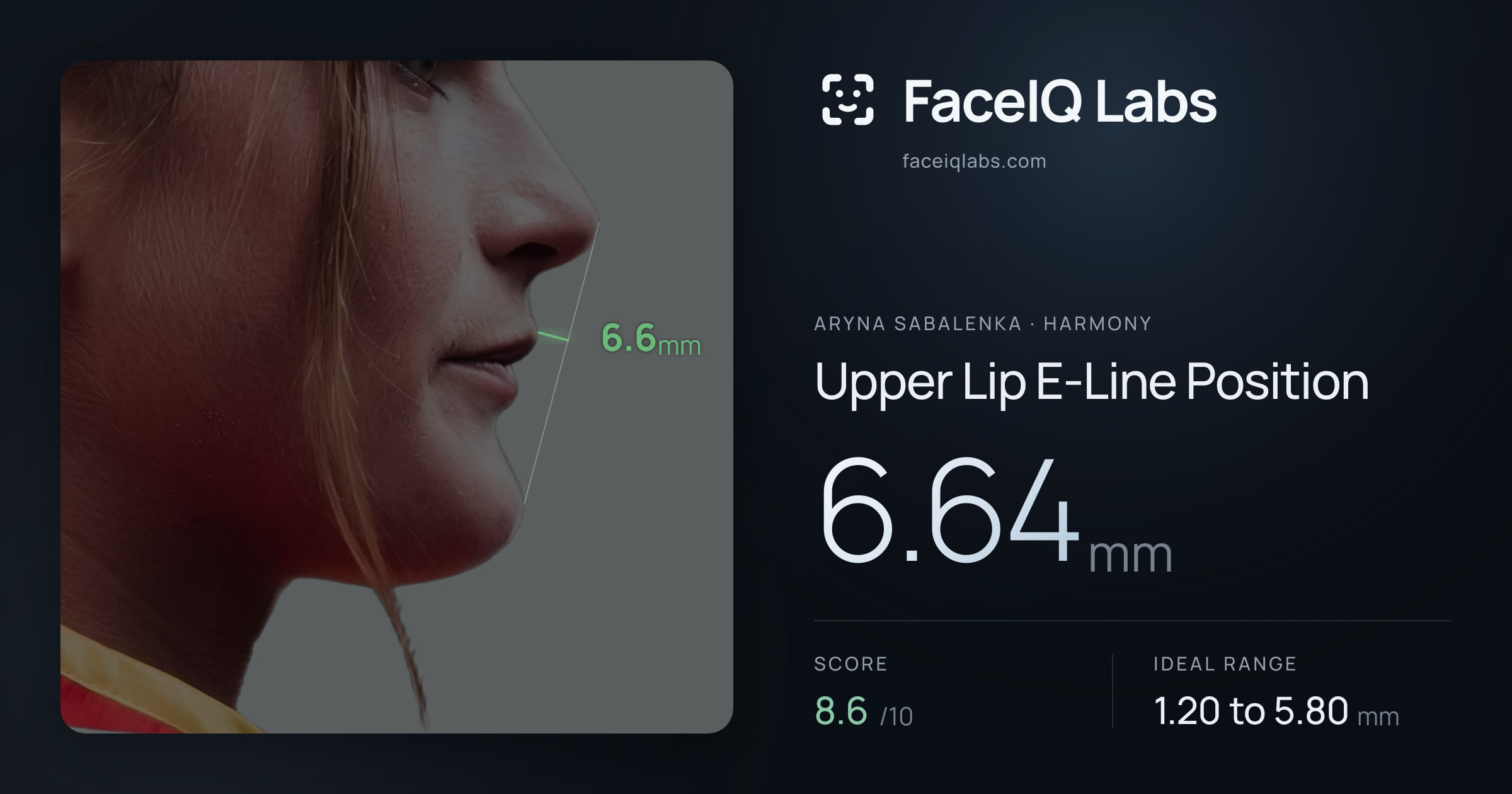 Aryna Sabalenka Upper Lip E-Line Position: 6.64mm, drawn on the photo