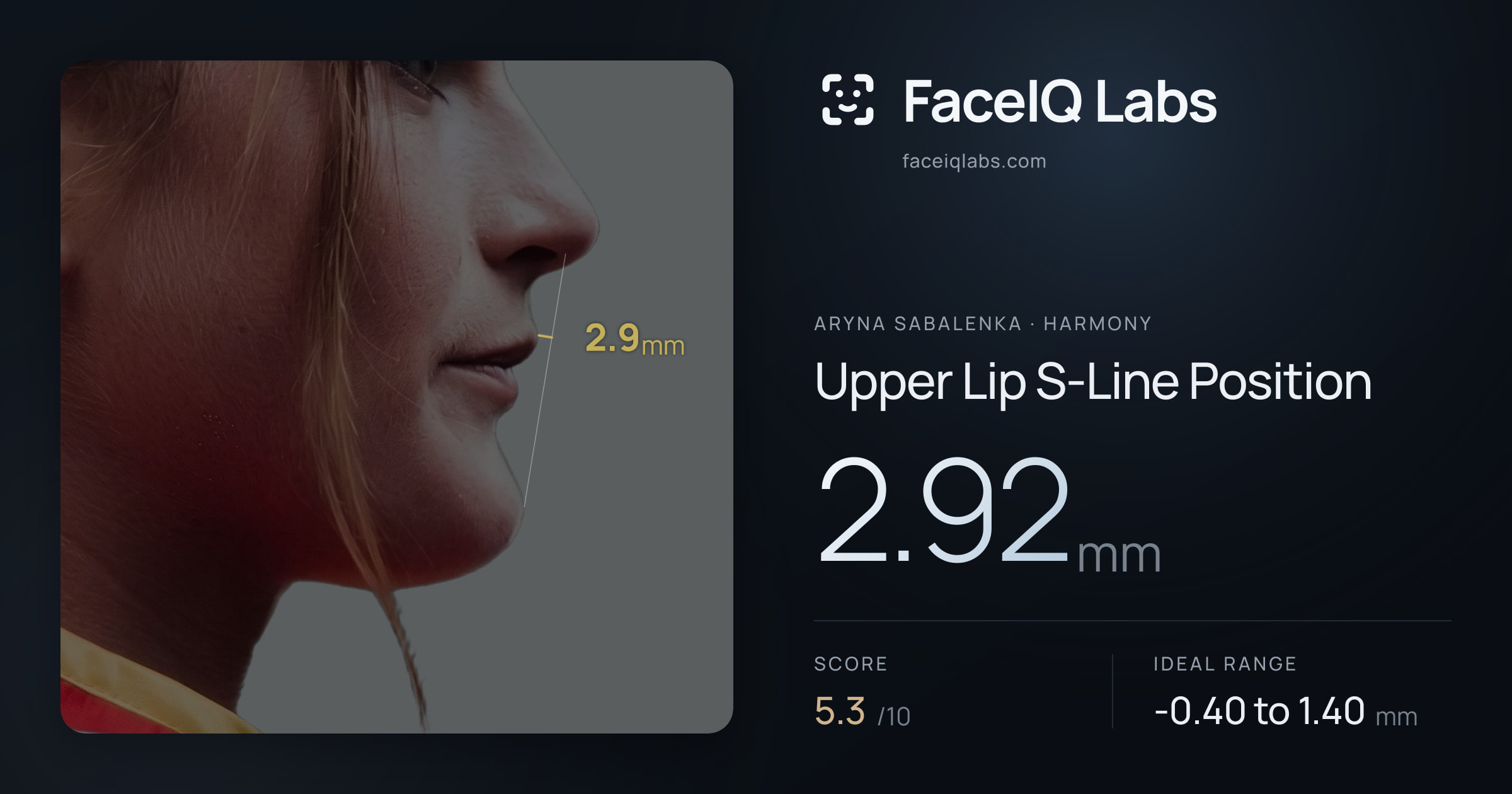 Aryna Sabalenka Upper Lip S-Line Position: 2.92mm, drawn on the photo