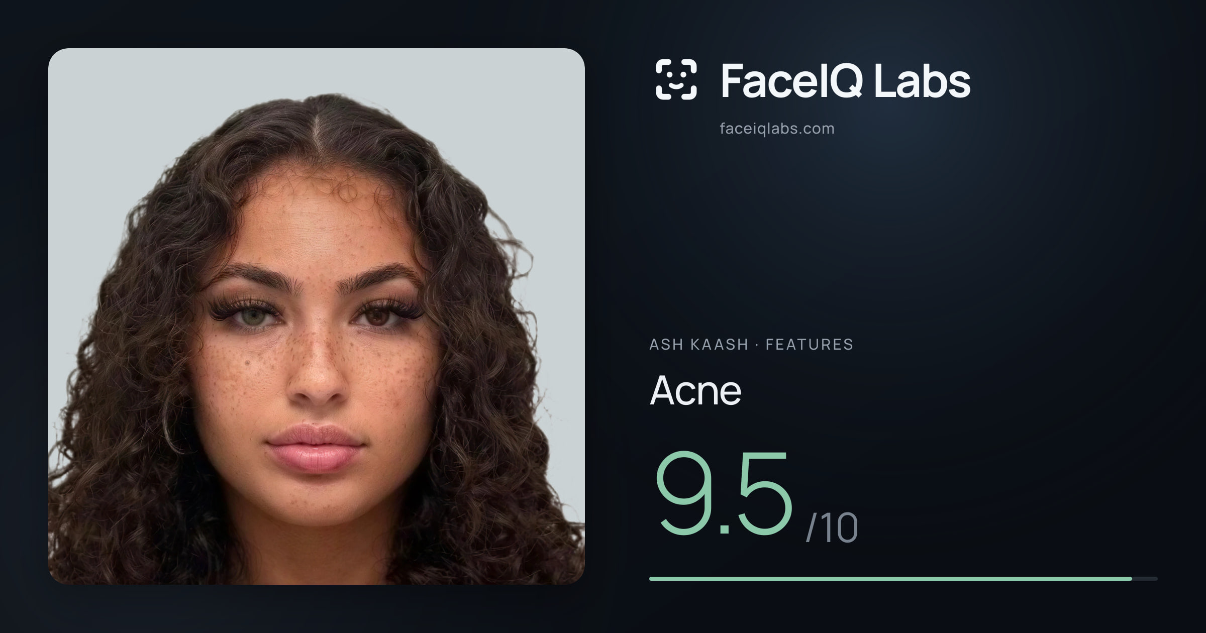 Ash Kaash Acne: 9.5/10, drawn on the photo