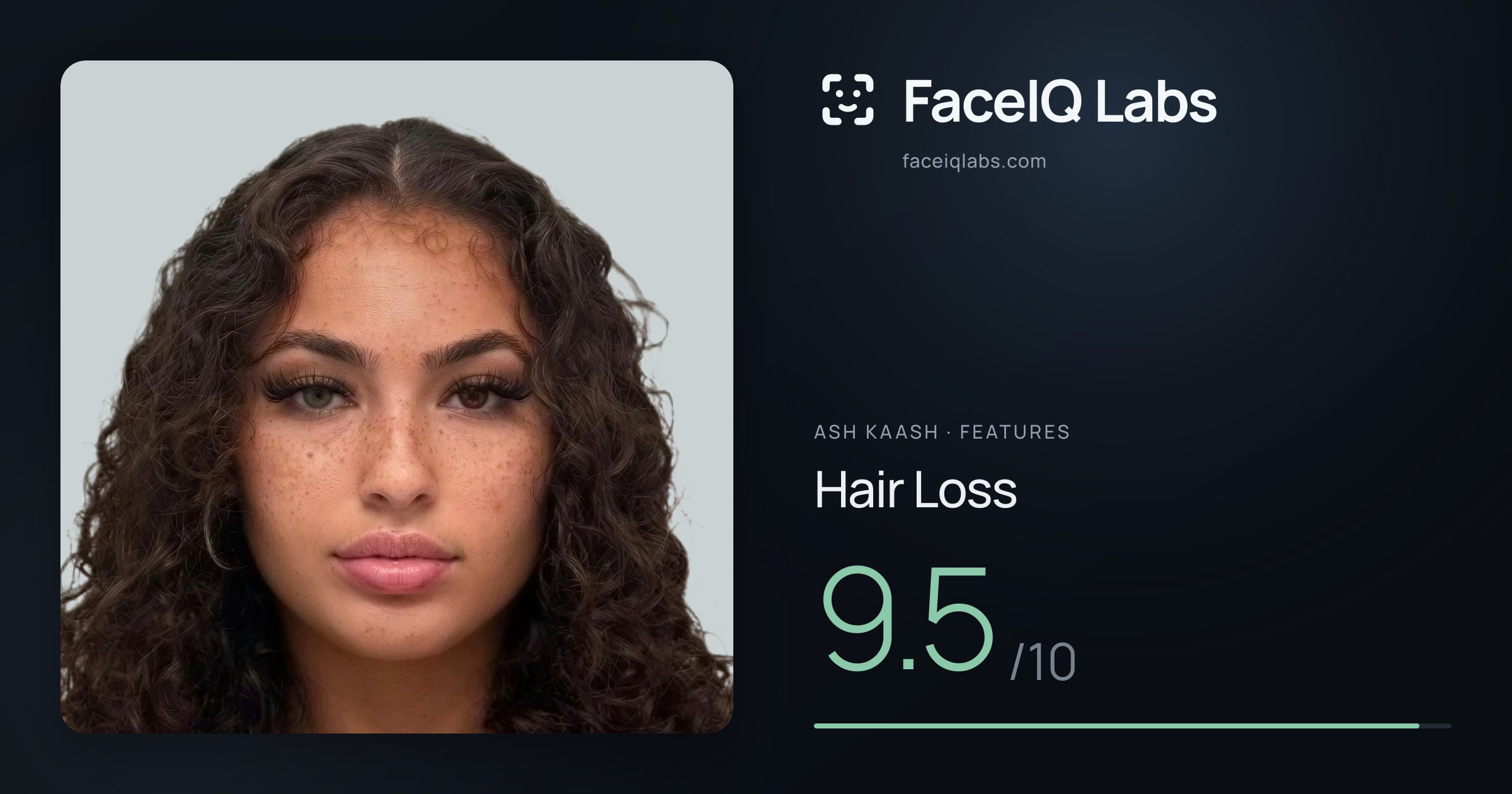 Ash Kaash Hair Loss: 9.5/10, drawn on the photo