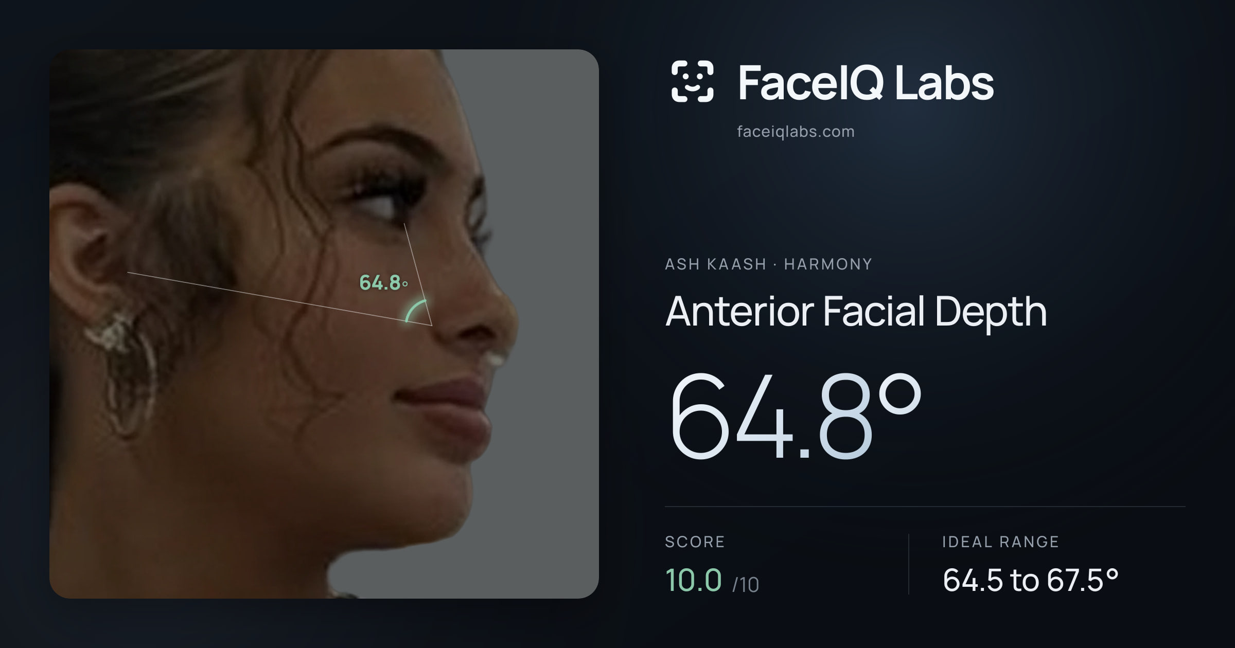 Ash Kaash Anterior Facial Depth: 64.8°, drawn on the photo