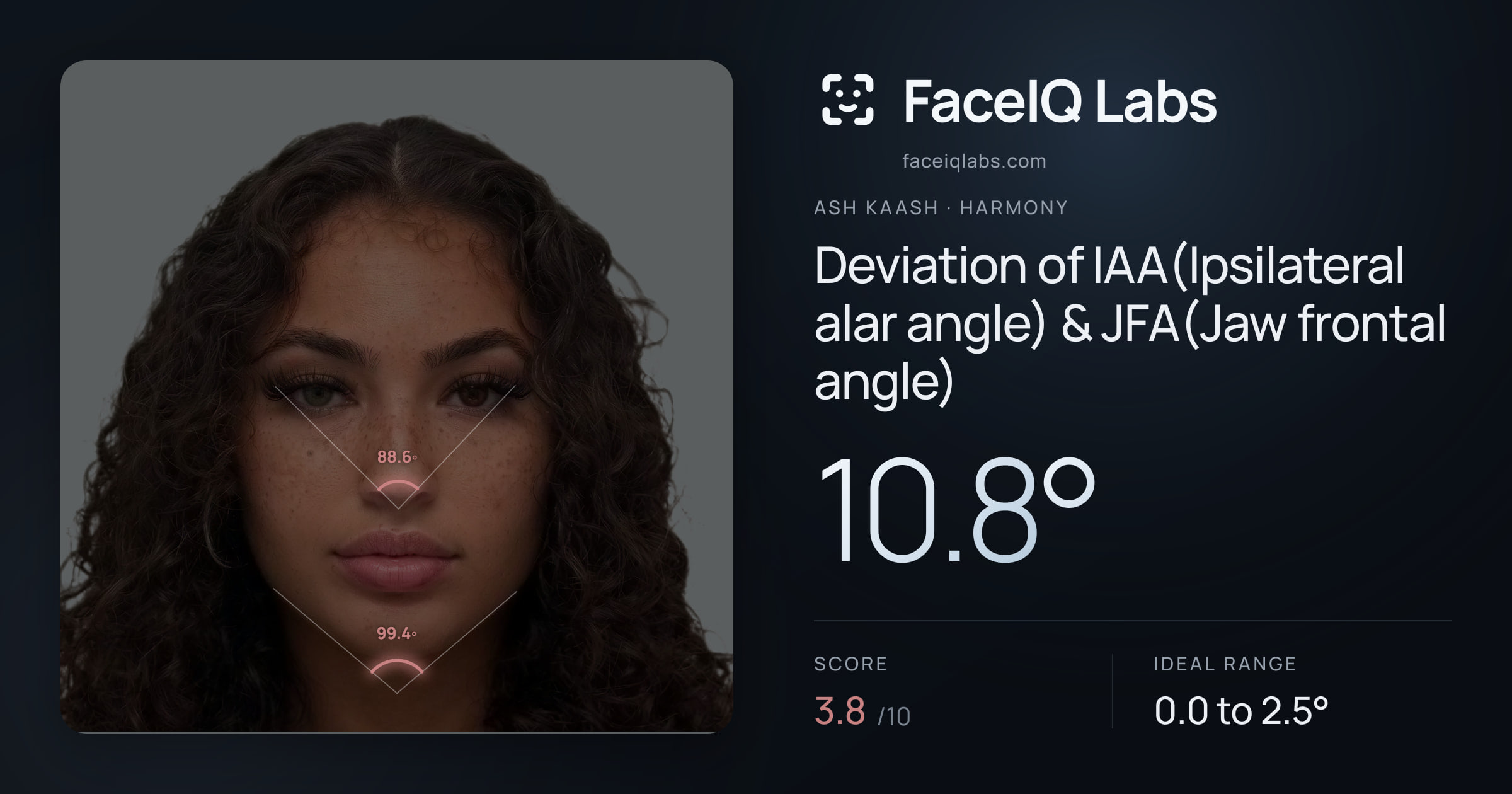 Ash Kaash Deviation of IAA(Ipsilateral alar angle) & JFA(Jaw frontal angle): 10.8°, drawn on the photo