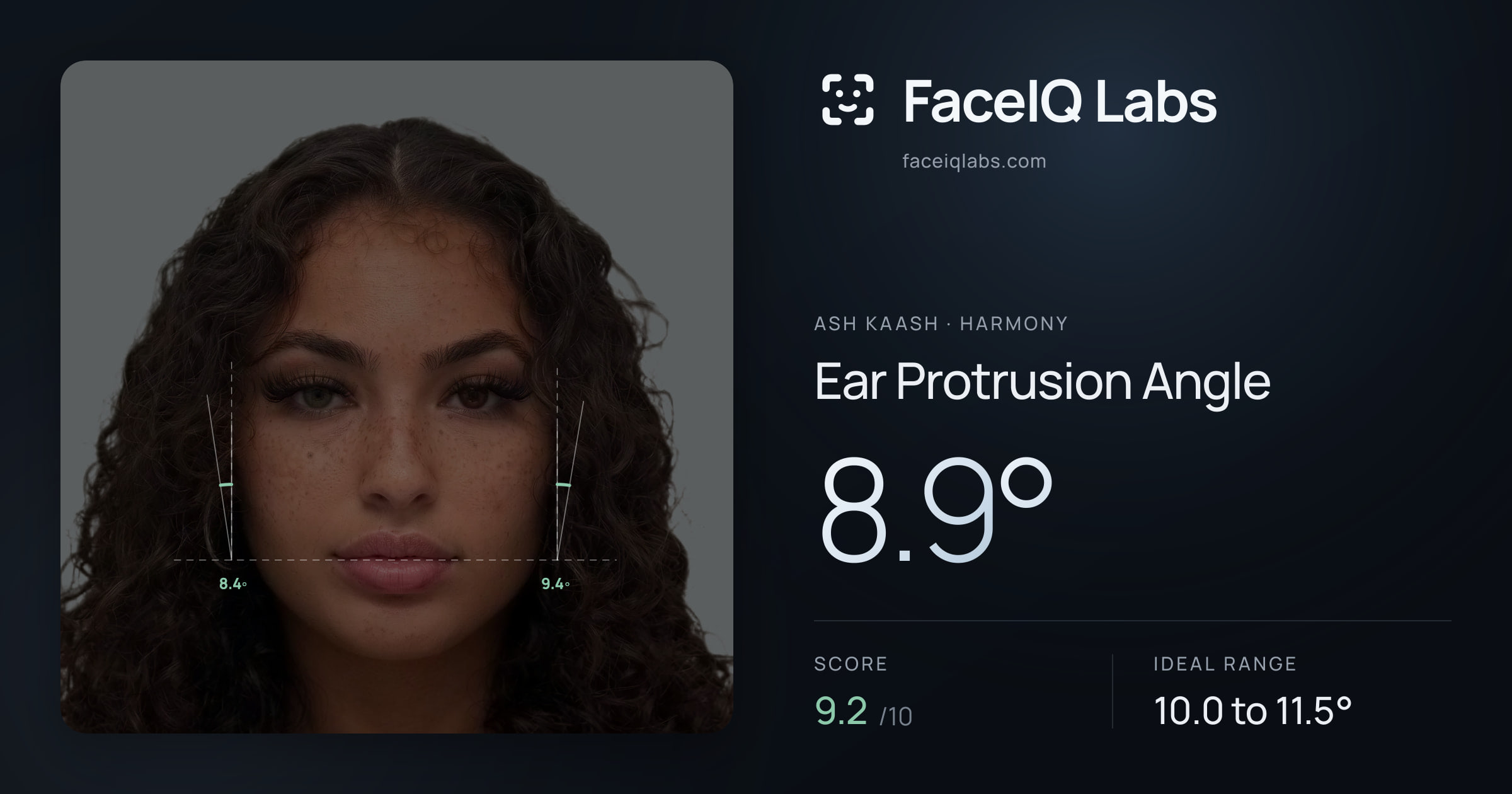 Ash Kaash Ear Protrusion Angle: 8.9°, drawn on the photo