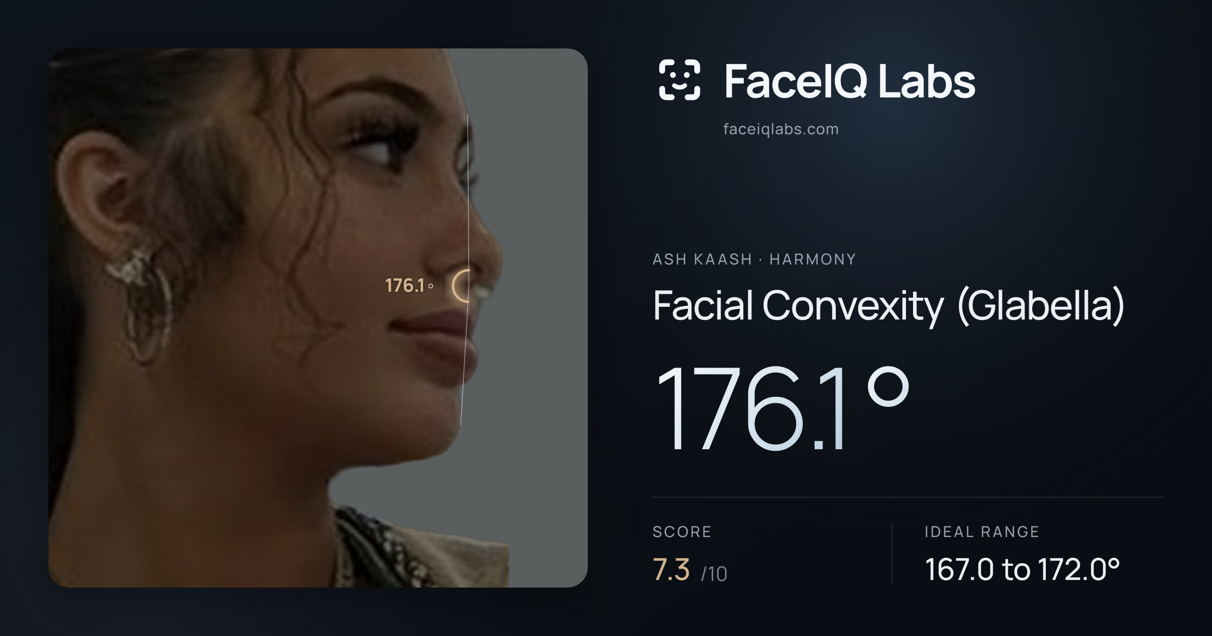 Ash Kaash Facial Convexity (Glabella): 176.1°, drawn on the photo