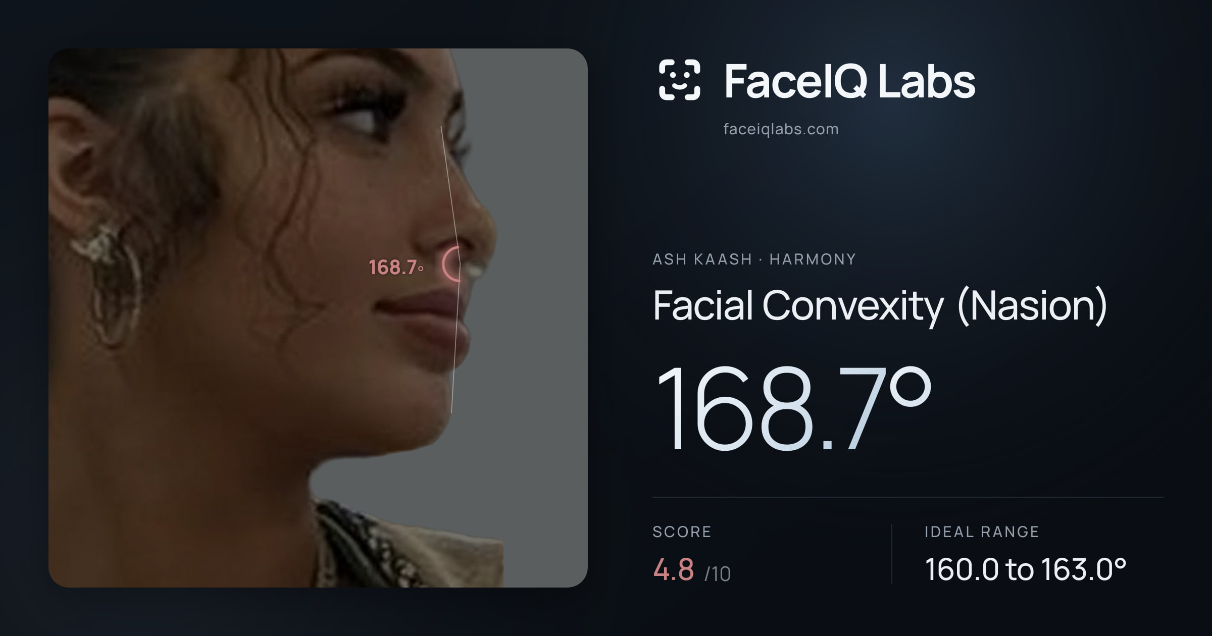 Ash Kaash Facial Convexity (Nasion): 168.7°, drawn on the photo