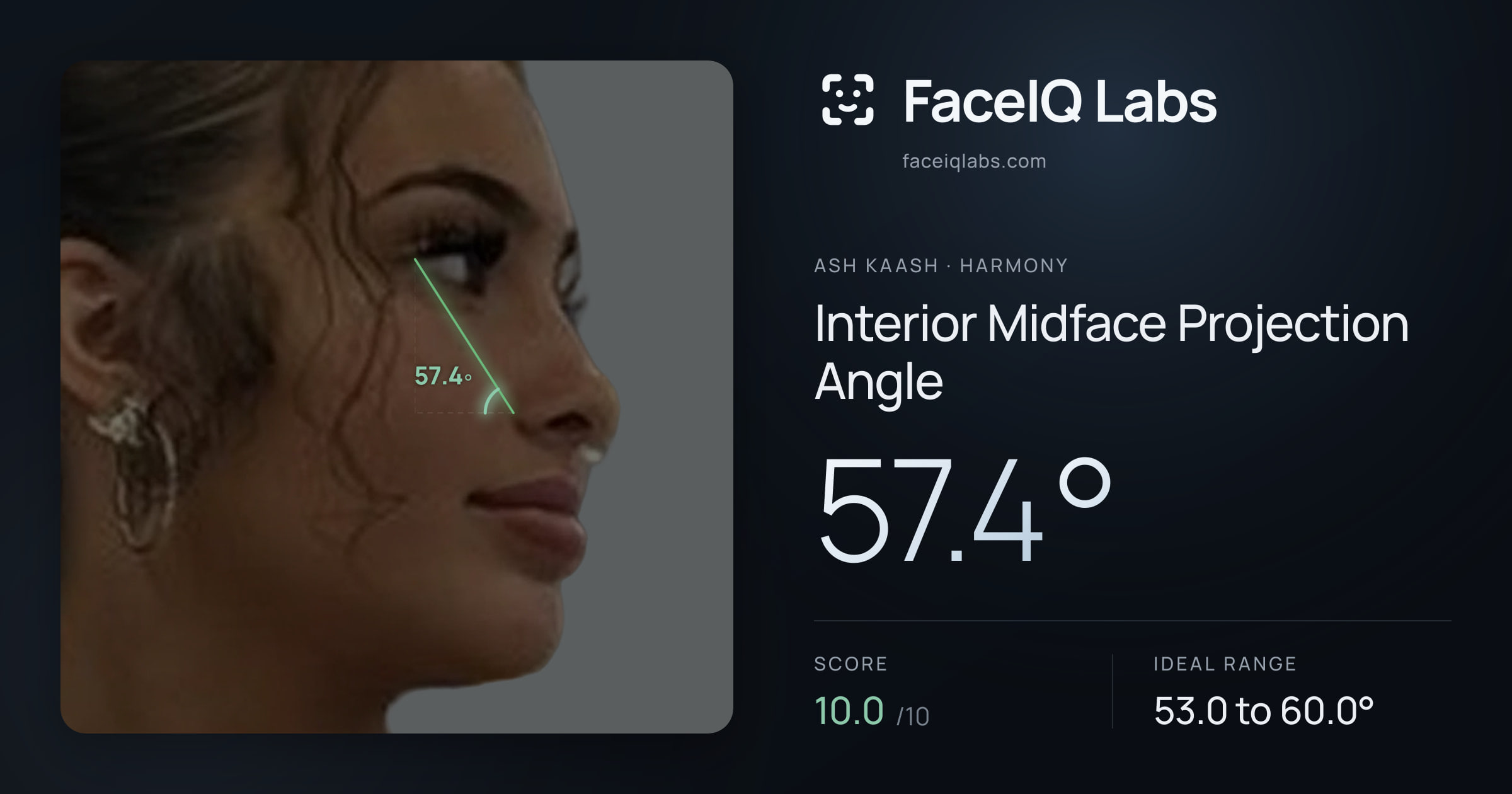 Ash Kaash Interior Midface Projection Angle: 57.4°, drawn on the photo