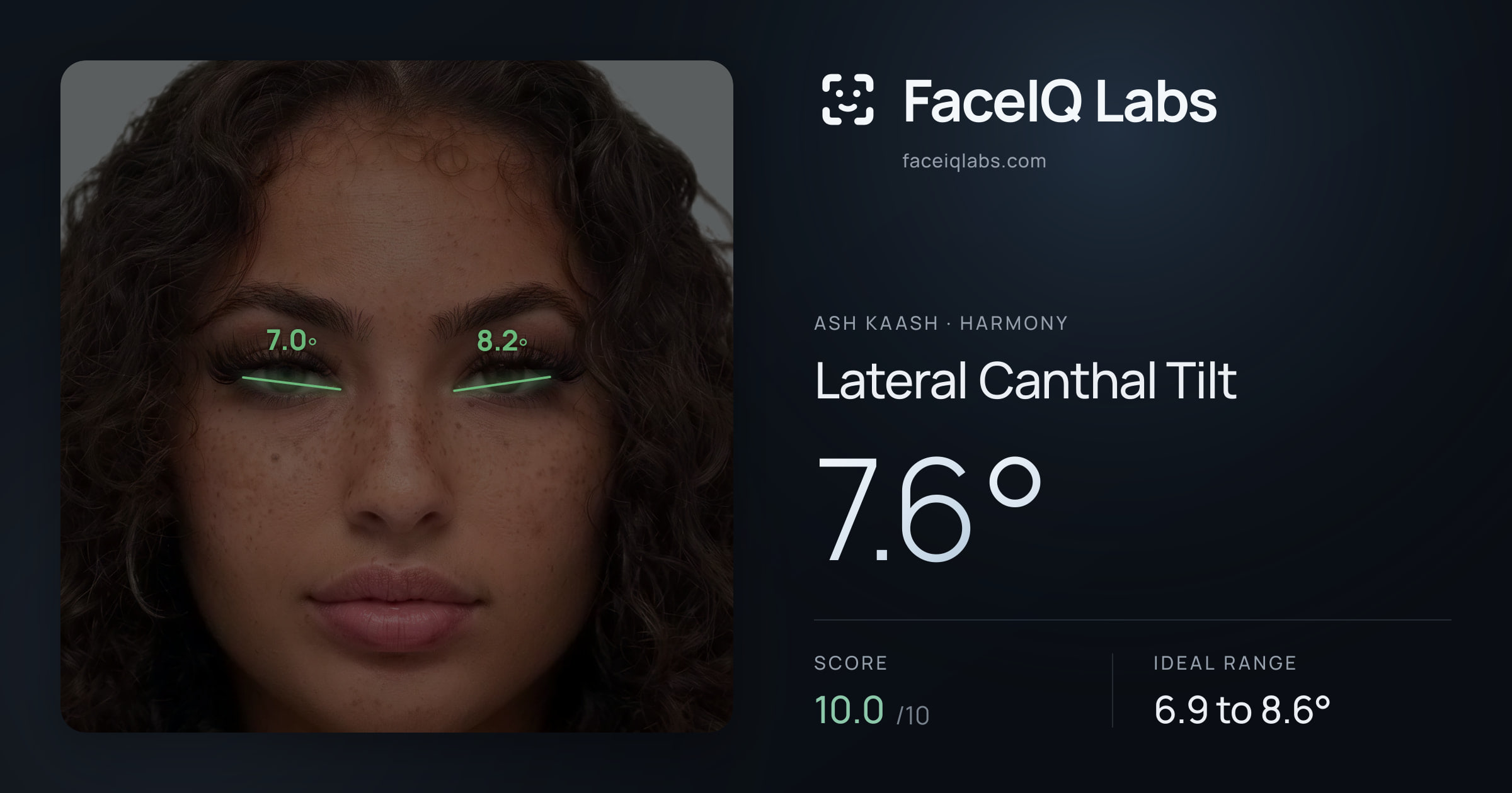 Ash Kaash Lateral Canthal Tilt: 7.6°, drawn on the photo