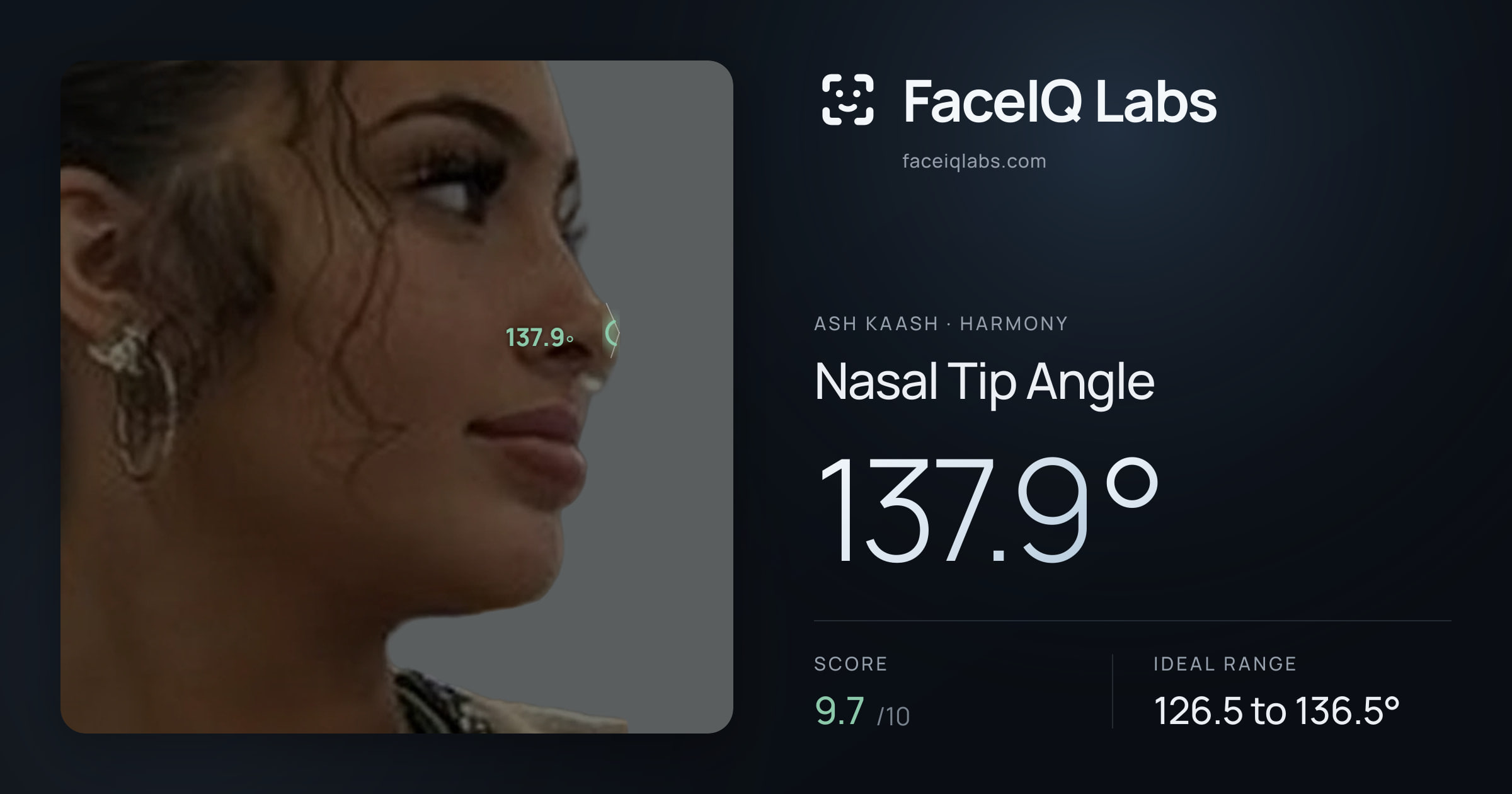 Ash Kaash Nasal Tip Angle: 137.9°, drawn on the photo