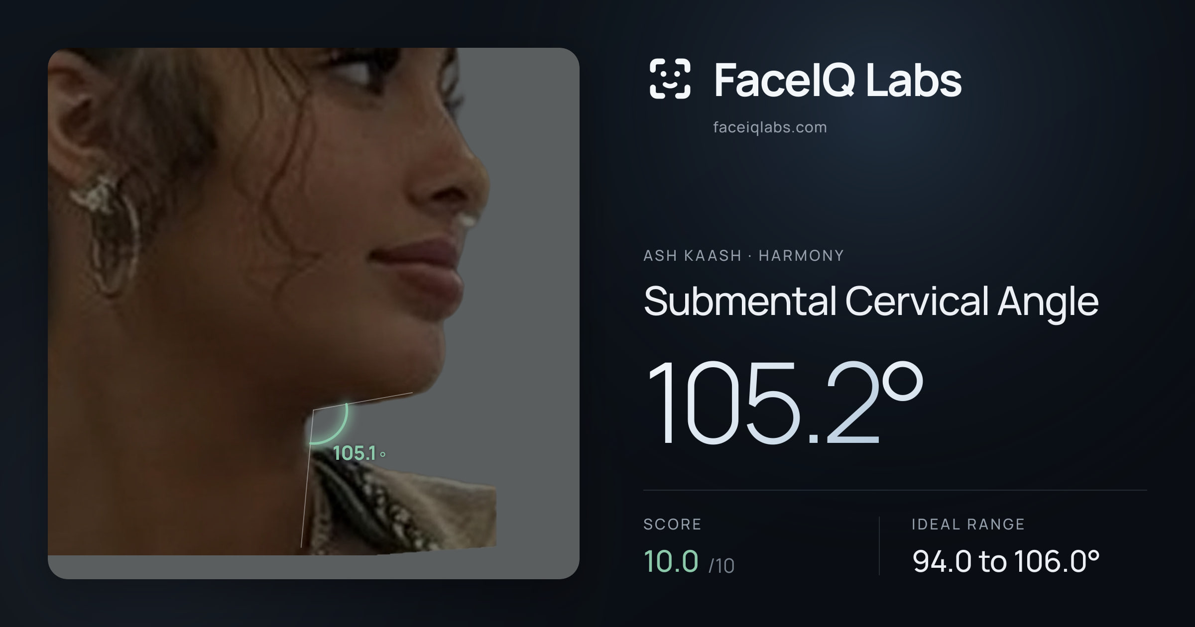 Ash Kaash Submental Cervical Angle: 105.2°, drawn on the photo