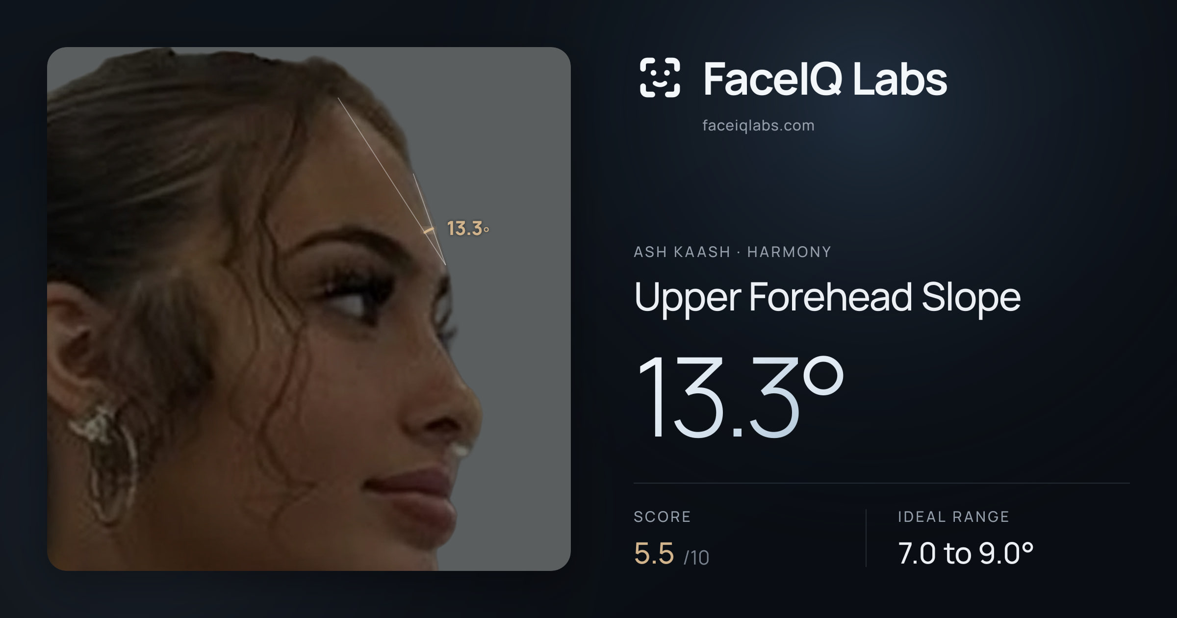 Ash Kaash Upper Forehead Slope: 13.3°, drawn on the photo