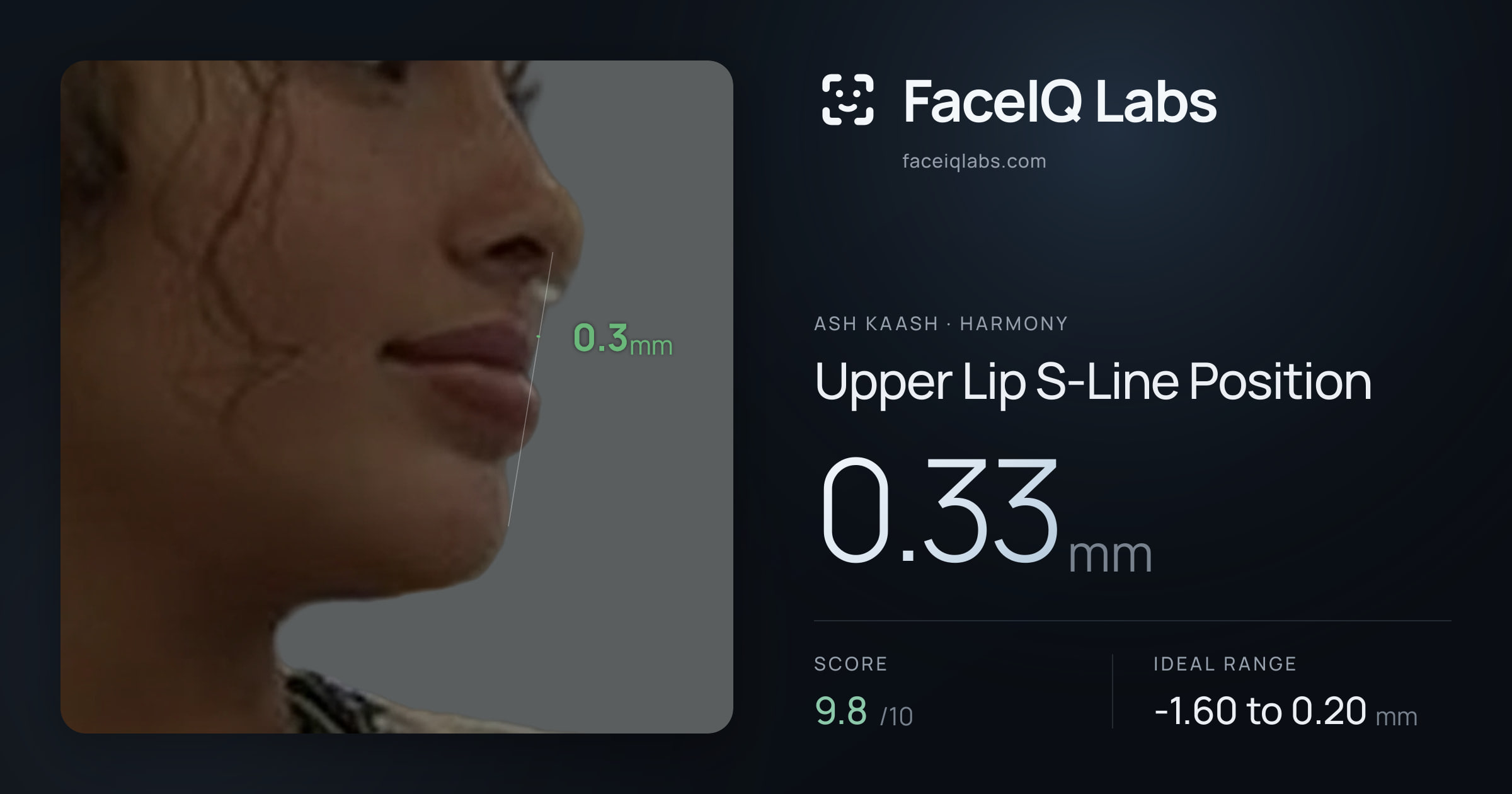 Ash Kaash Upper Lip S-Line Position: 0.33mm, drawn on the photo