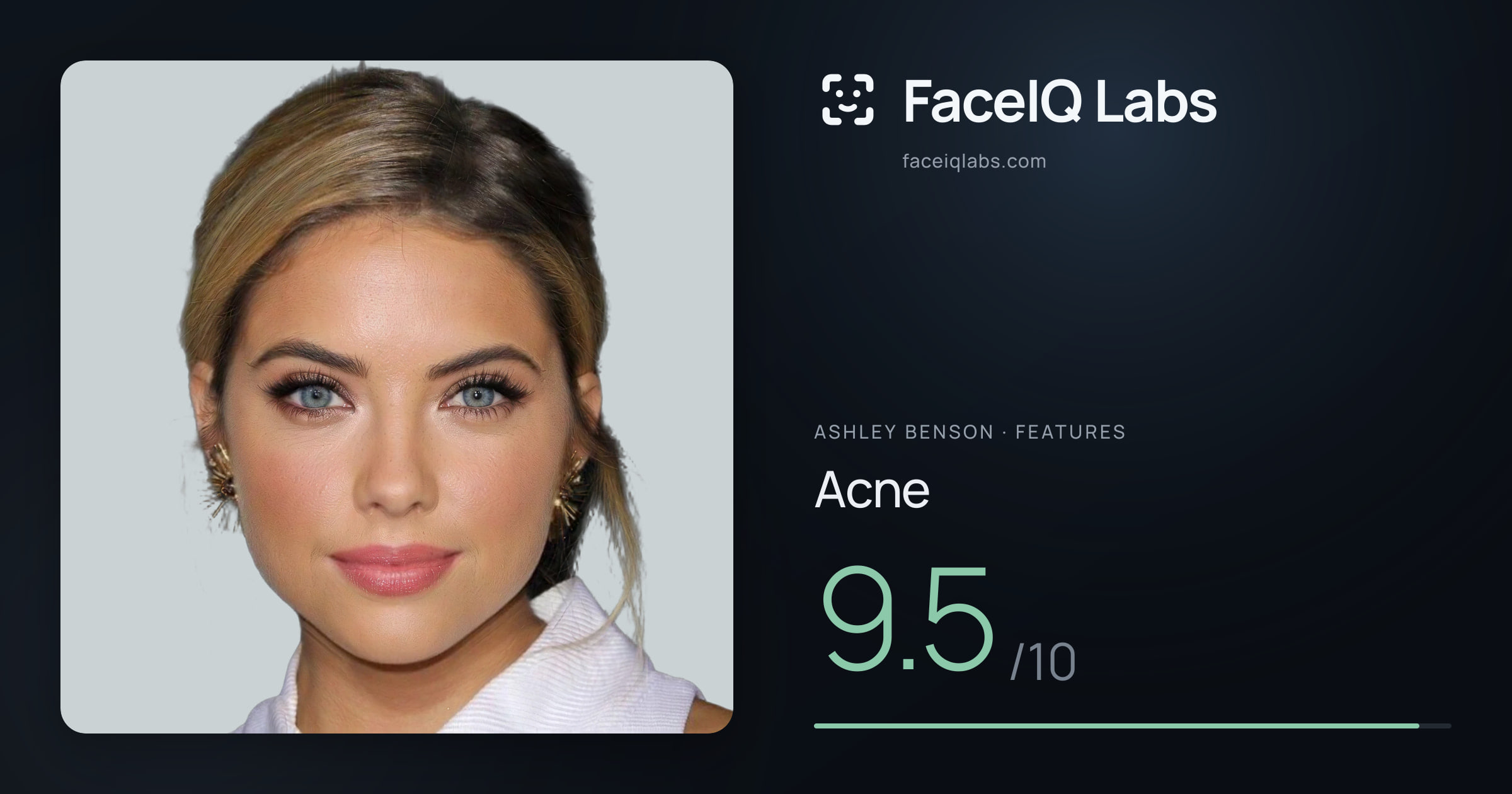 Ashley Benson Acne: 9.5/10, drawn on the photo