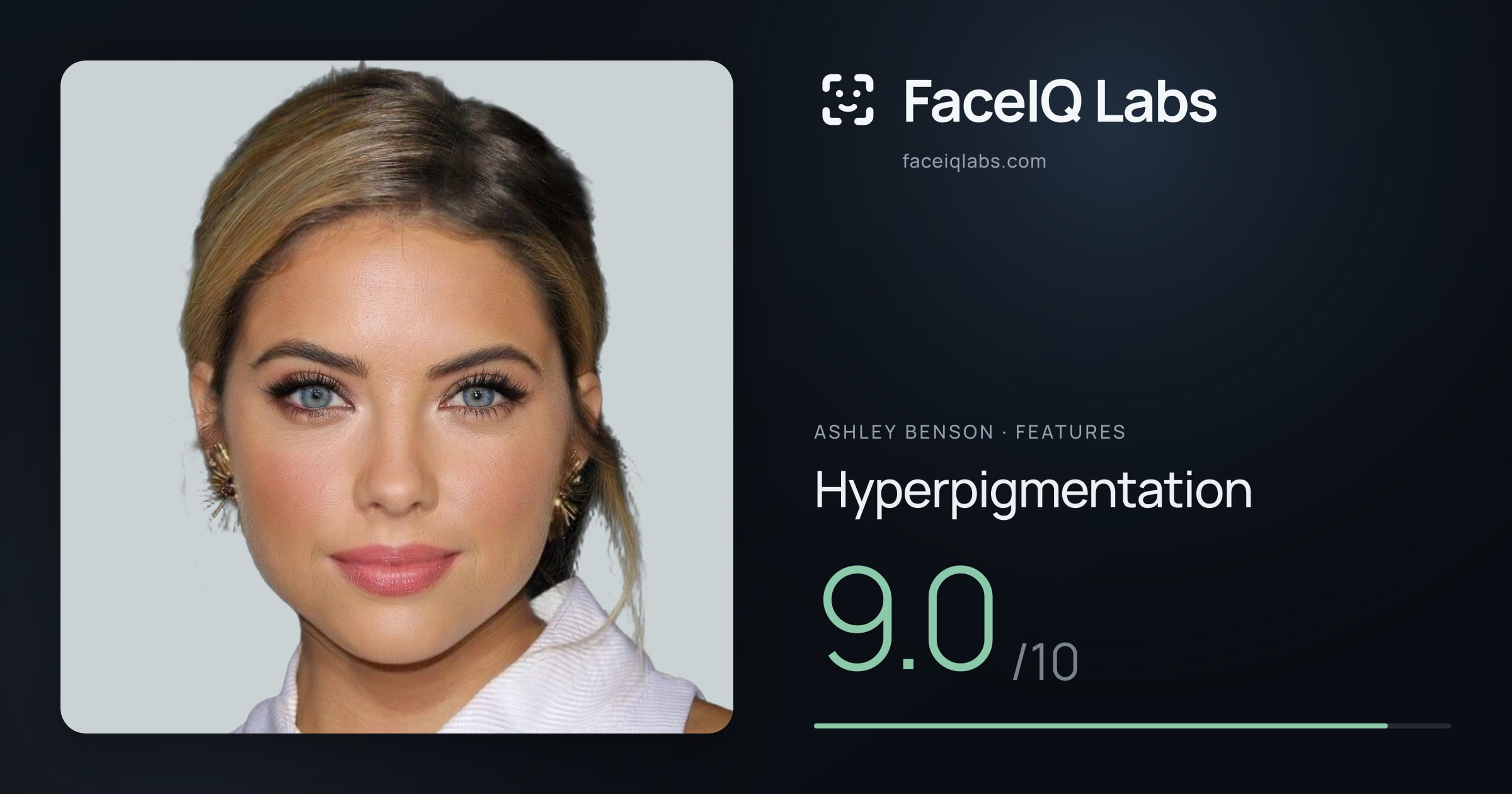 Ashley Benson Hyperpigmentation: 9.0/10, drawn on the photo