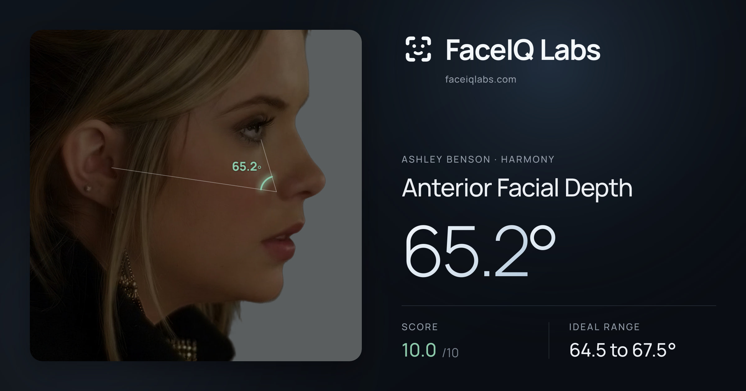 Ashley Benson Anterior Facial Depth: 65.2°, drawn on the photo
