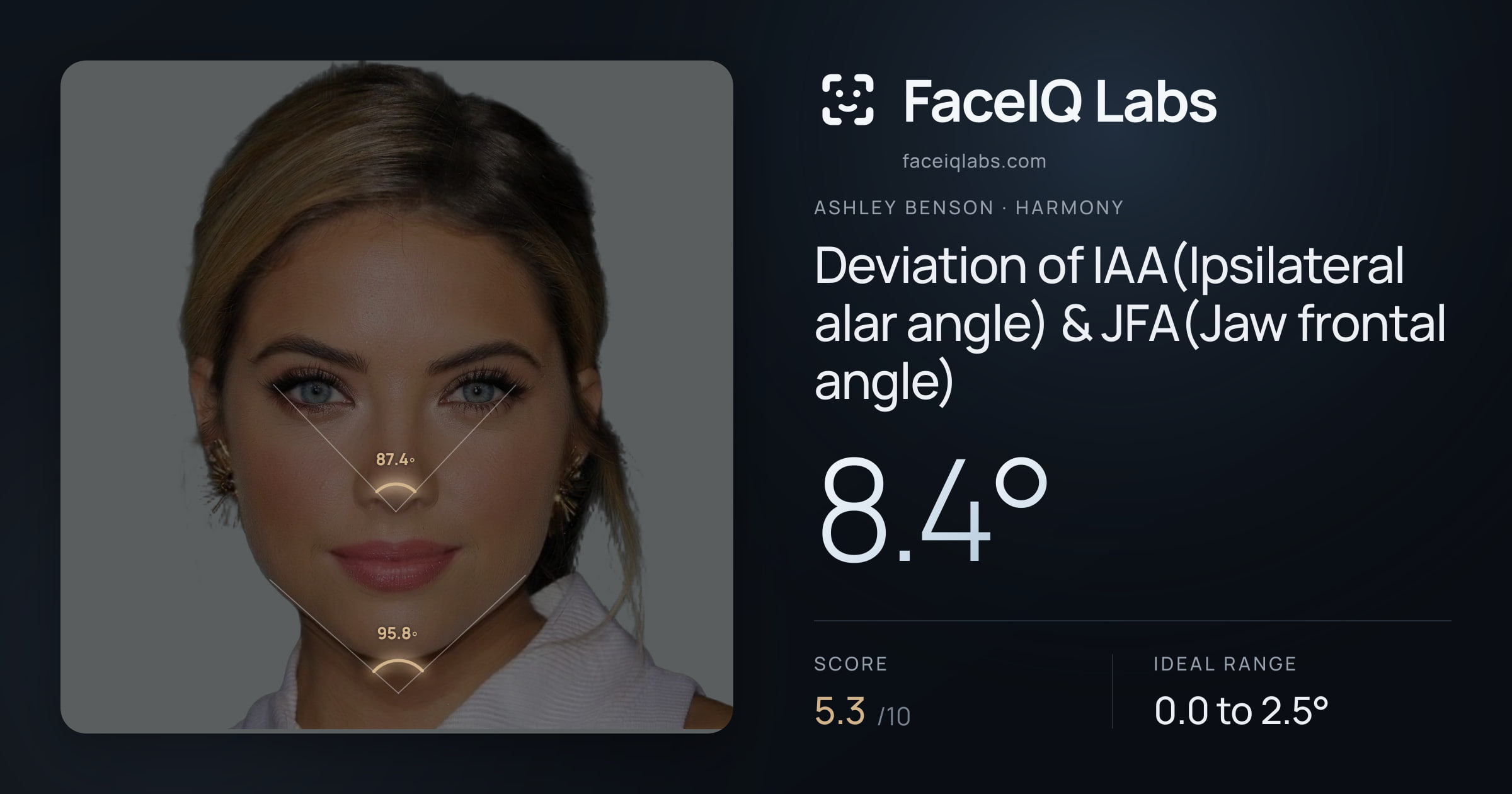 Ashley Benson Deviation of IAA(Ipsilateral alar angle) & JFA(Jaw frontal angle): 8.4°, drawn on the photo