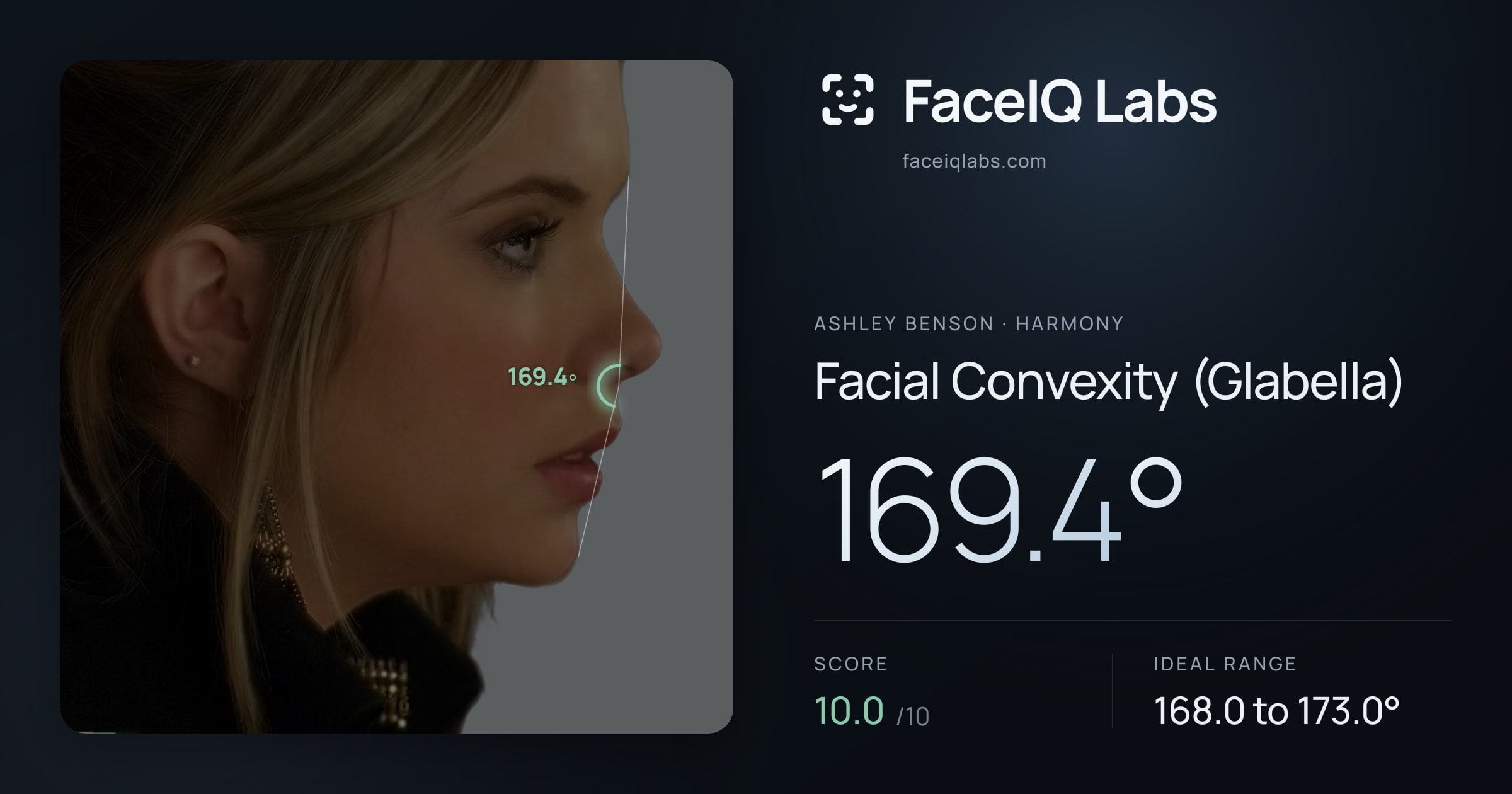 Ashley Benson Facial Convexity (Glabella): 169.4°, drawn on the photo