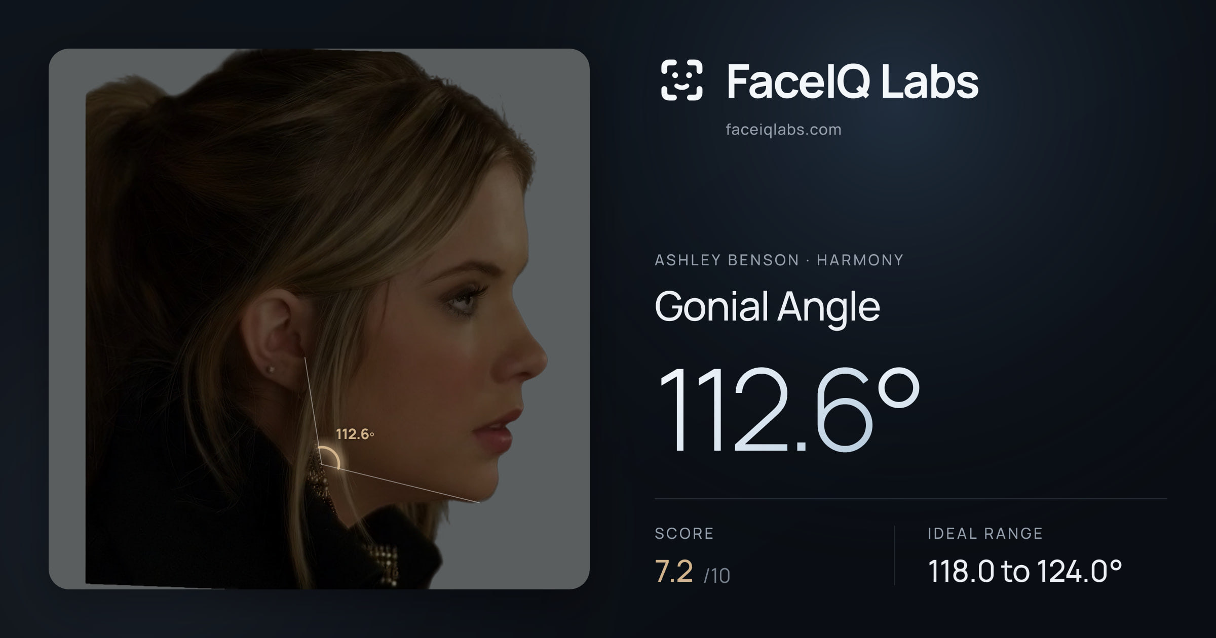 Ashley Benson Gonial Angle: 112.6°, drawn on the photo