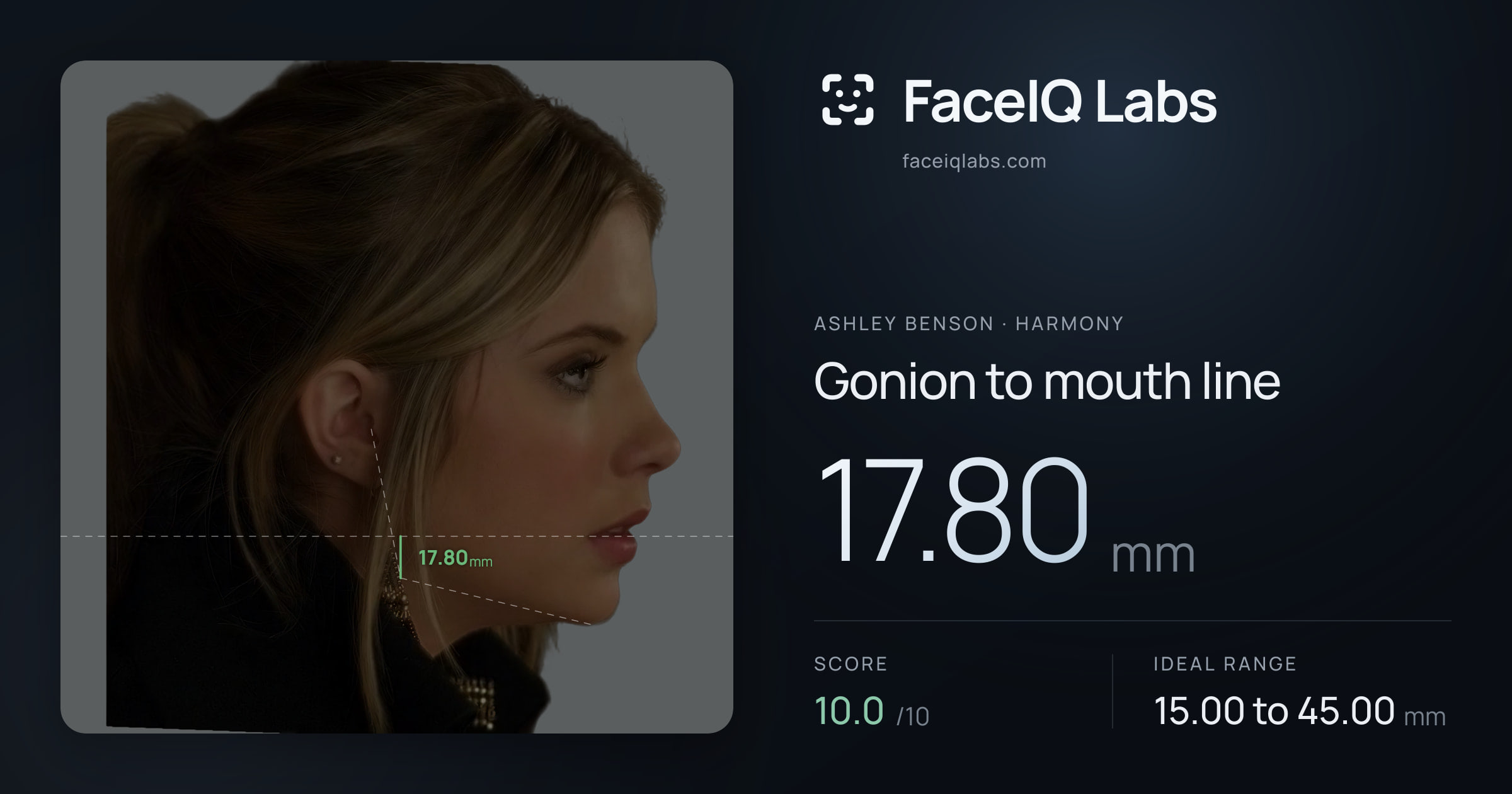 Ashley Benson Gonion to mouth line: 17.80mm, drawn on the photo