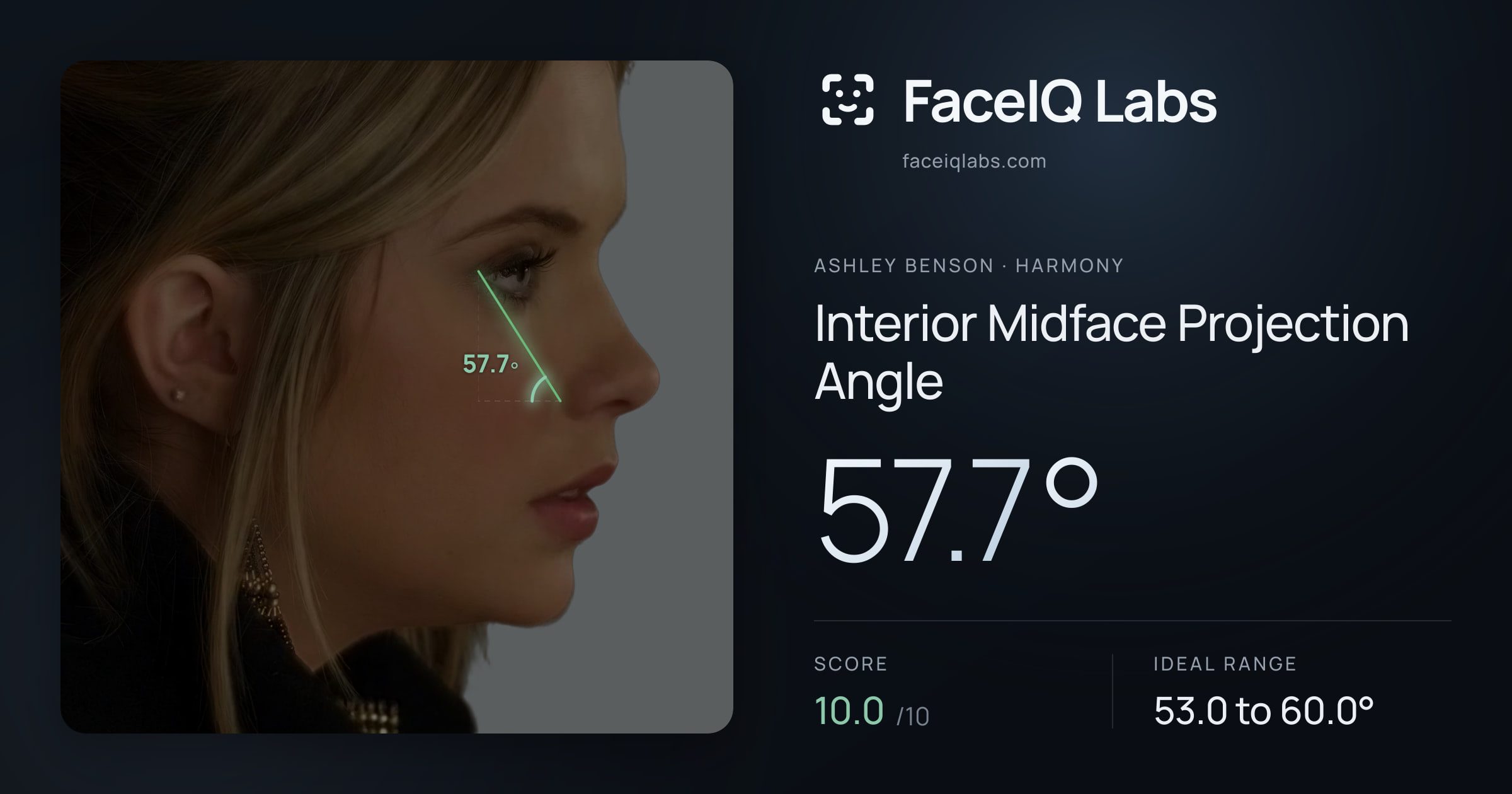 Ashley Benson Interior Midface Projection Angle: 57.7°, drawn on the photo