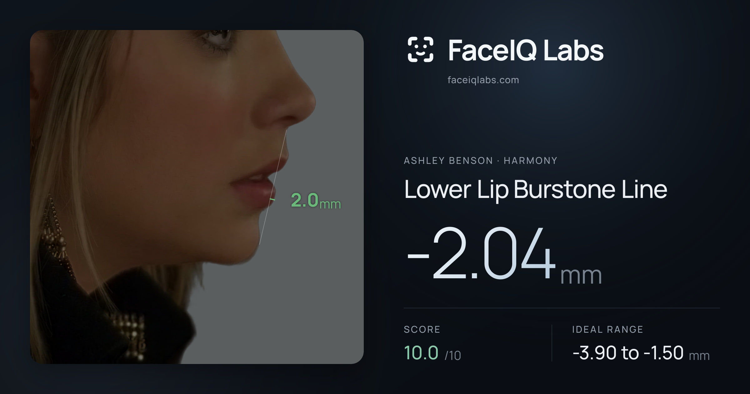 Ashley Benson Lower Lip Burstone Line: -2.04mm, drawn on the photo