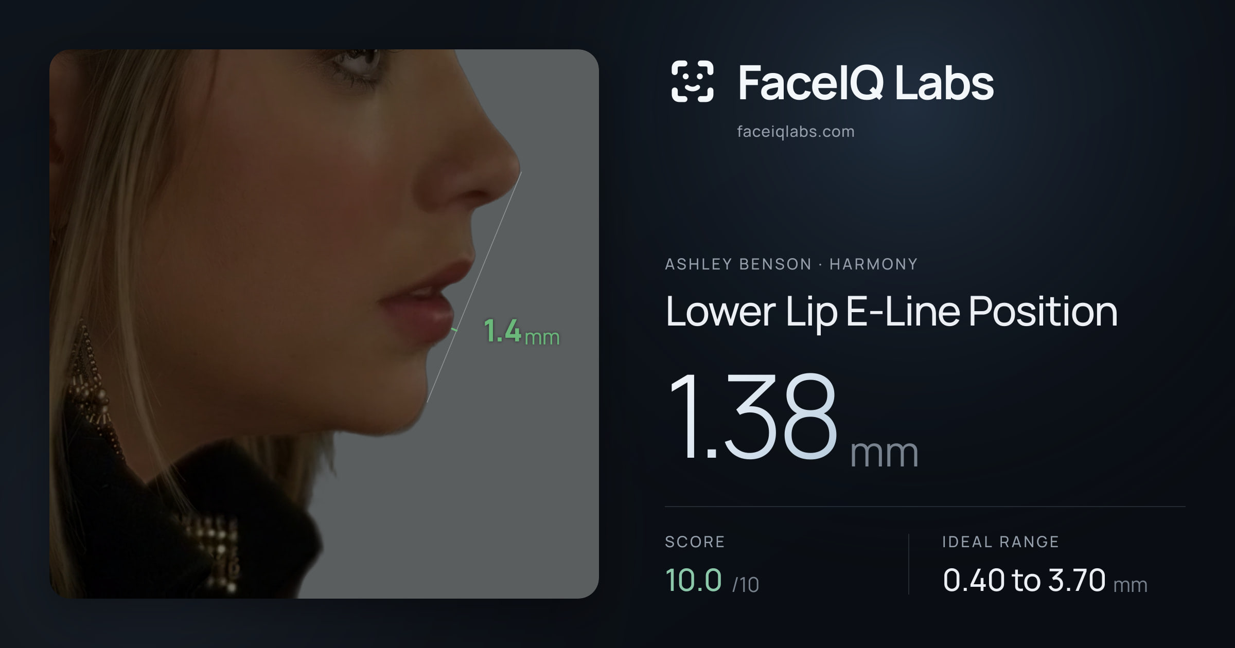 Ashley Benson Lower Lip E-Line Position: 1.38mm, drawn on the photo