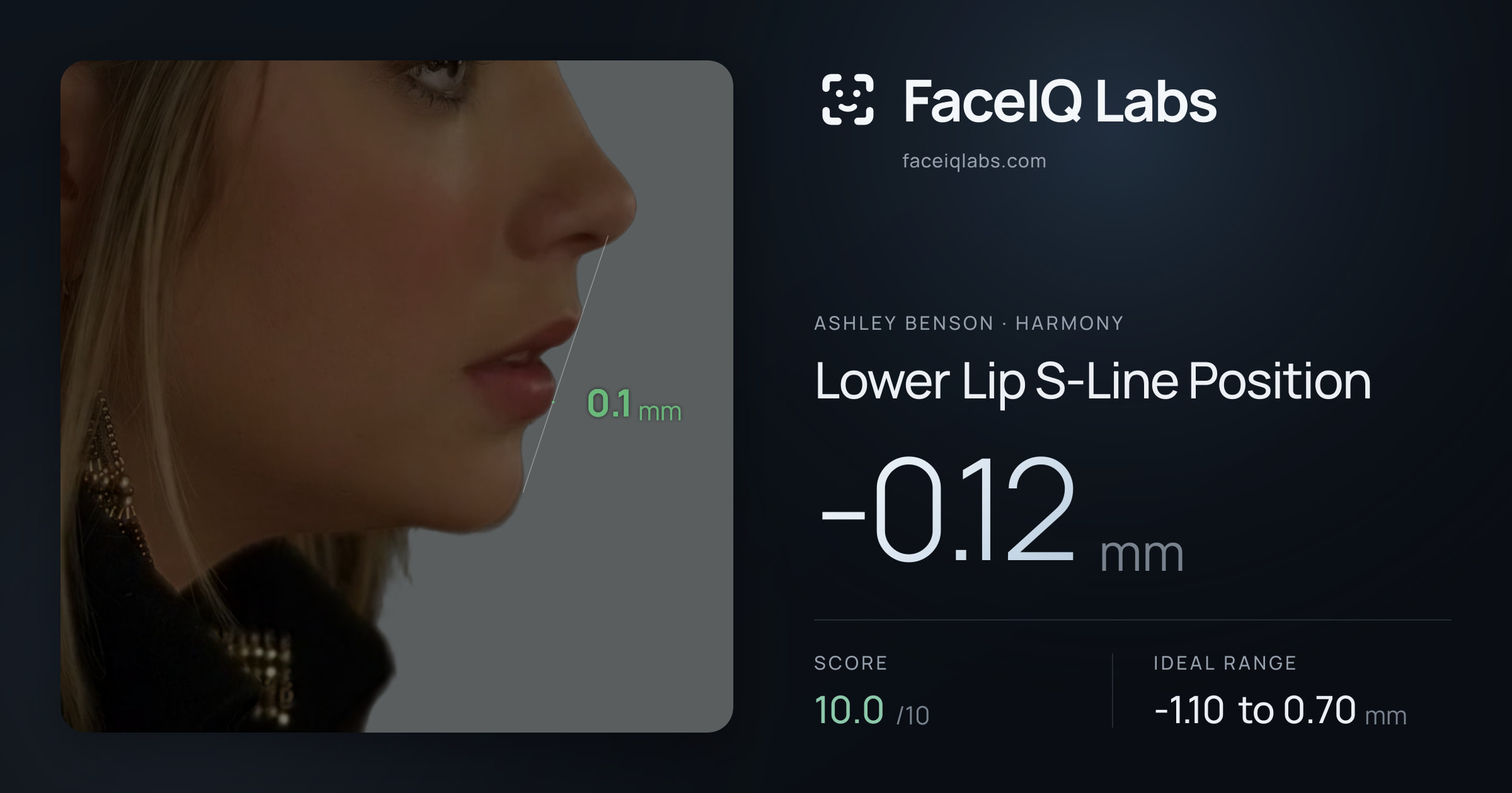 Ashley Benson Lower Lip S-Line Position: -0.12mm, drawn on the photo