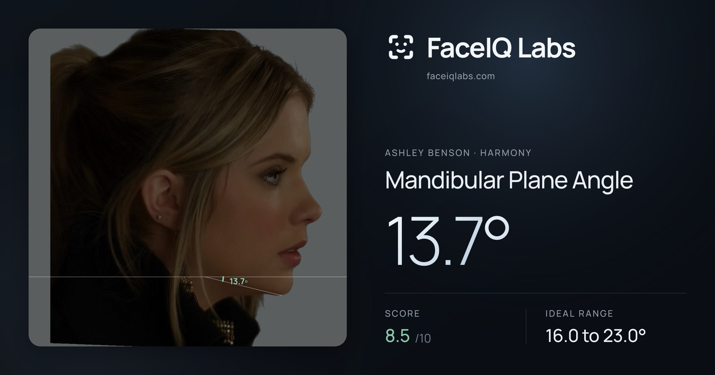 Ashley Benson Mandibular Plane Angle: 13.7°, drawn on the photo