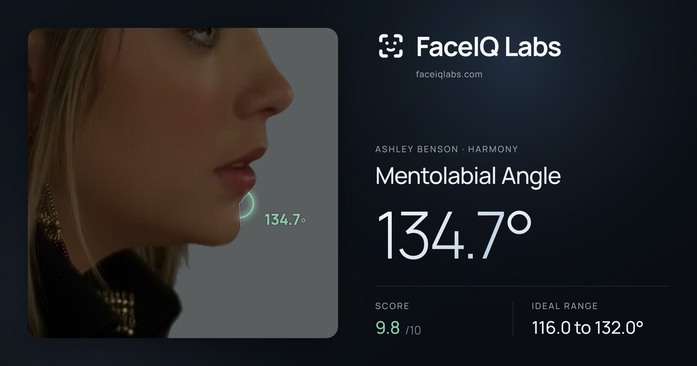 Ashley Benson Mentolabial Angle: 134.7°, drawn on the photo