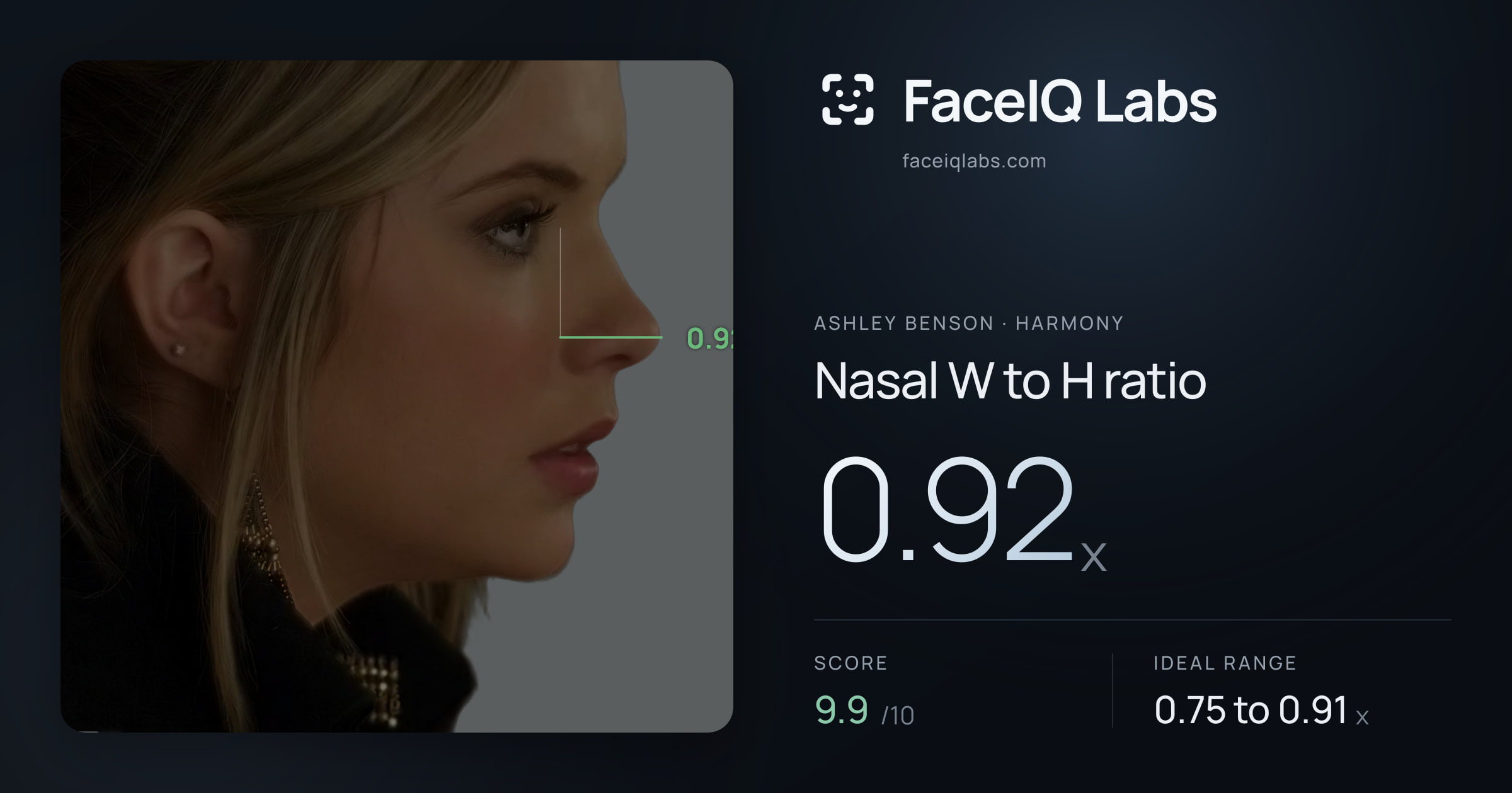 Ashley Benson Nasal W to H ratio: 0.92x, drawn on the photo