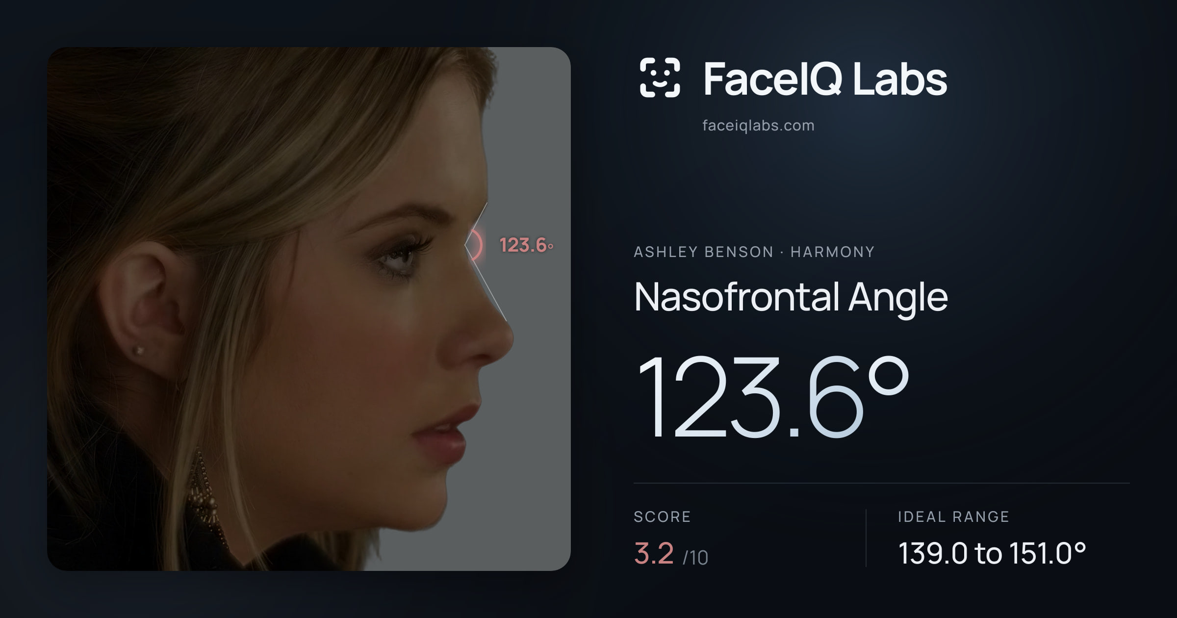 Ashley Benson Nasofrontal Angle: 123.6°, drawn on the photo