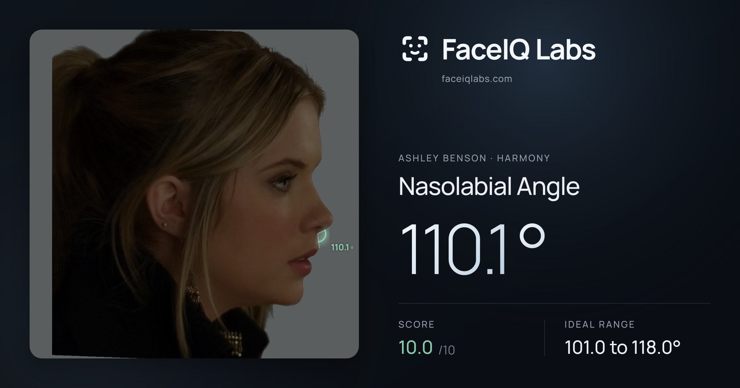 Ashley Benson Nasolabial Angle: 110.1°, drawn on the photo