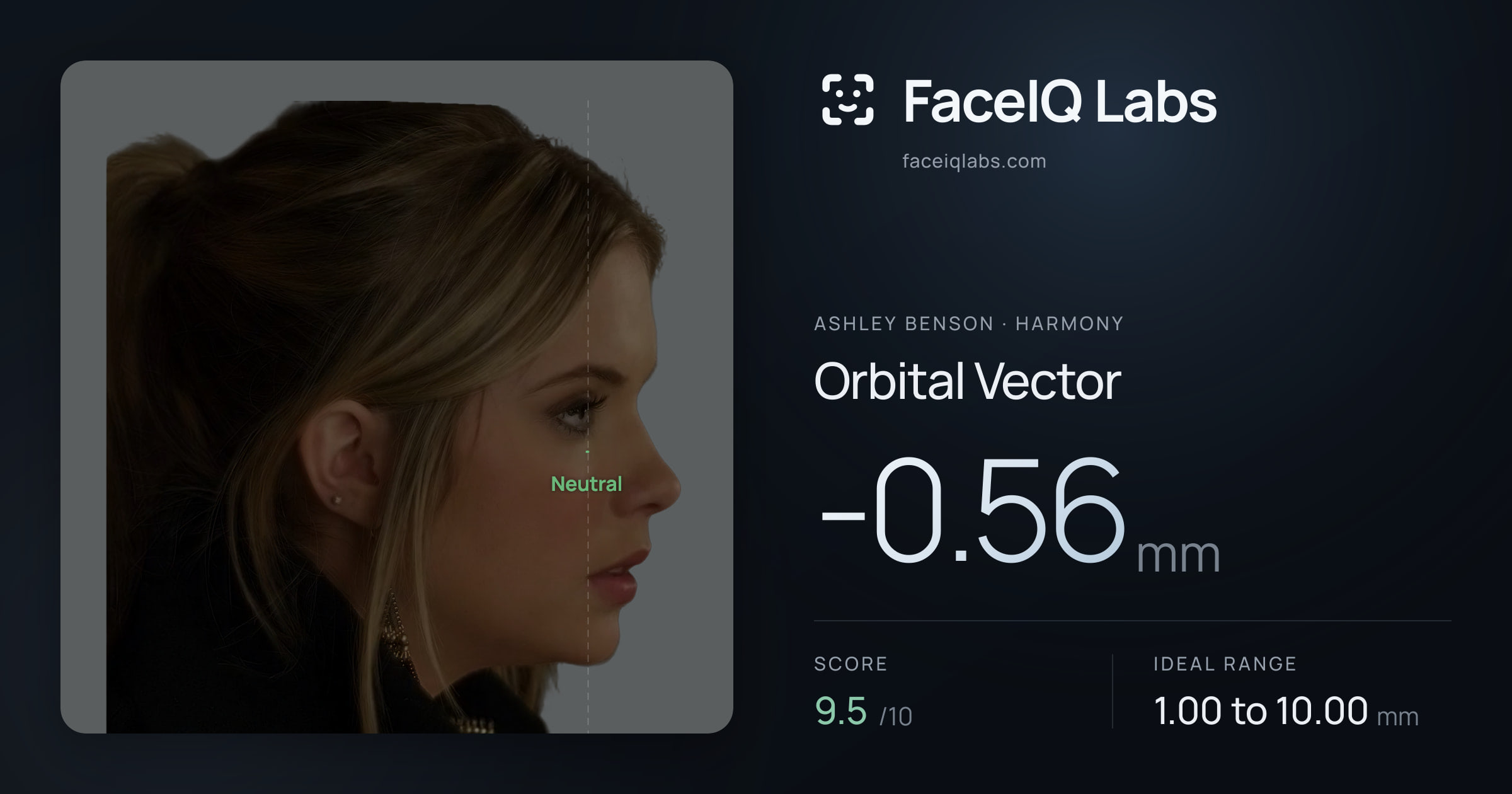 Ashley Benson Orbital Vector: -0.56mm, drawn on the photo