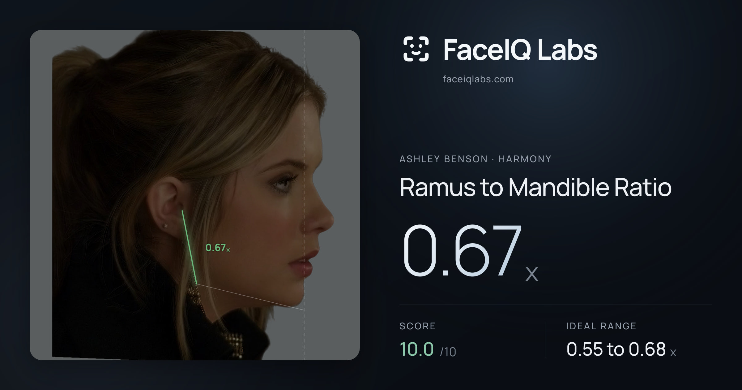 Ashley Benson Ramus to Mandible Ratio: 0.67x, drawn on the photo