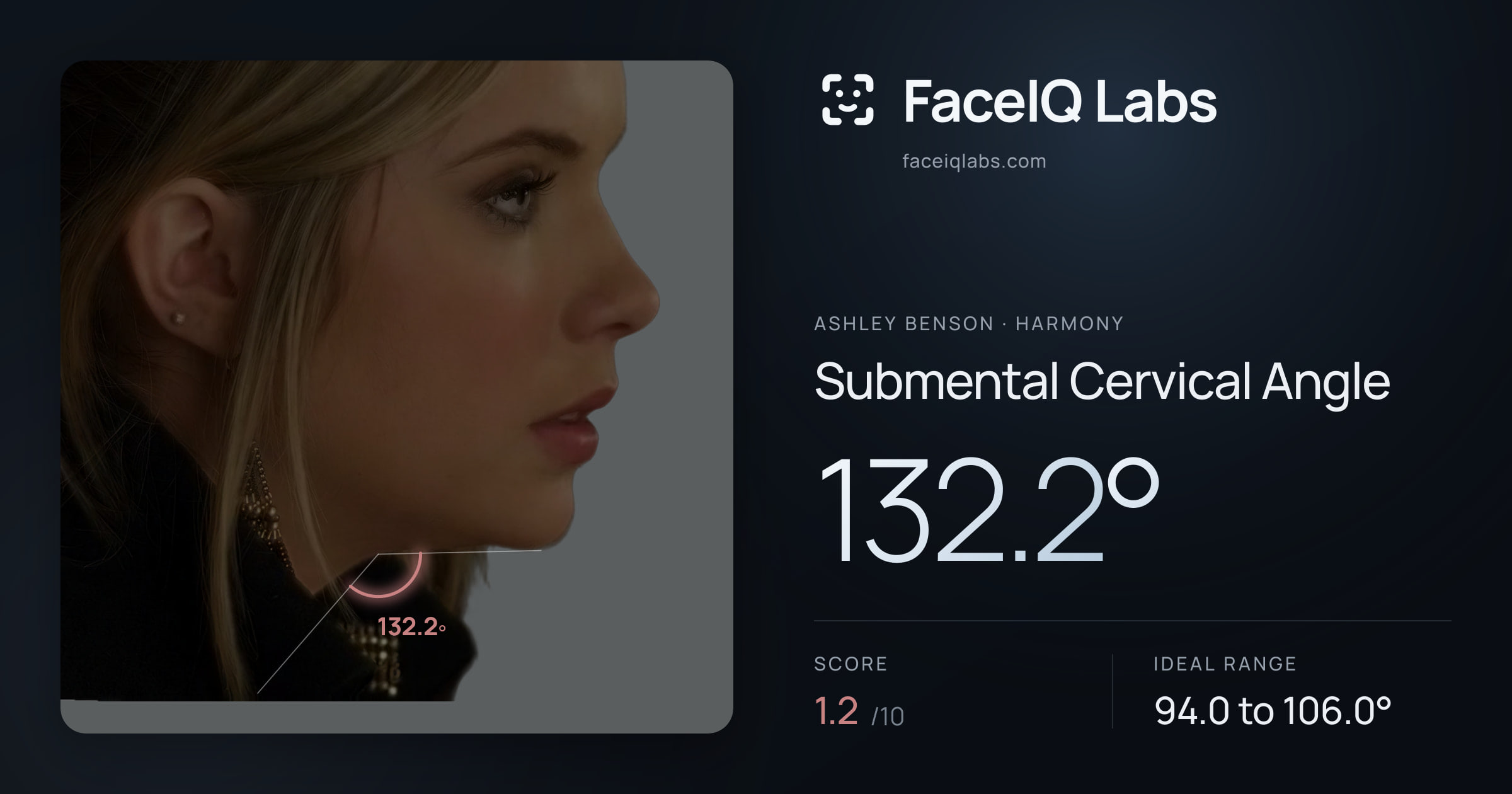 Ashley Benson Submental Cervical Angle: 132.2°, drawn on the photo