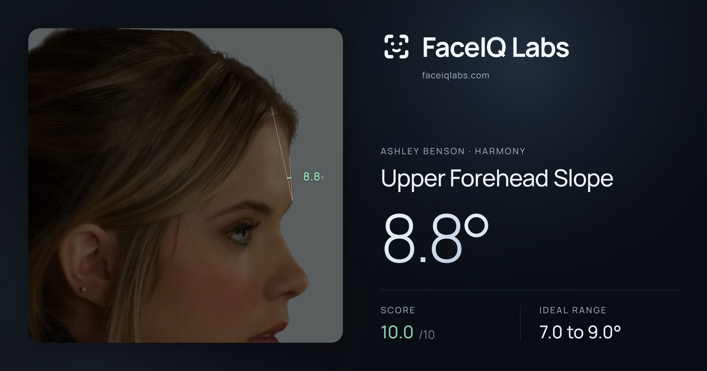 Ashley Benson Upper Forehead Slope: 8.8°, drawn on the photo