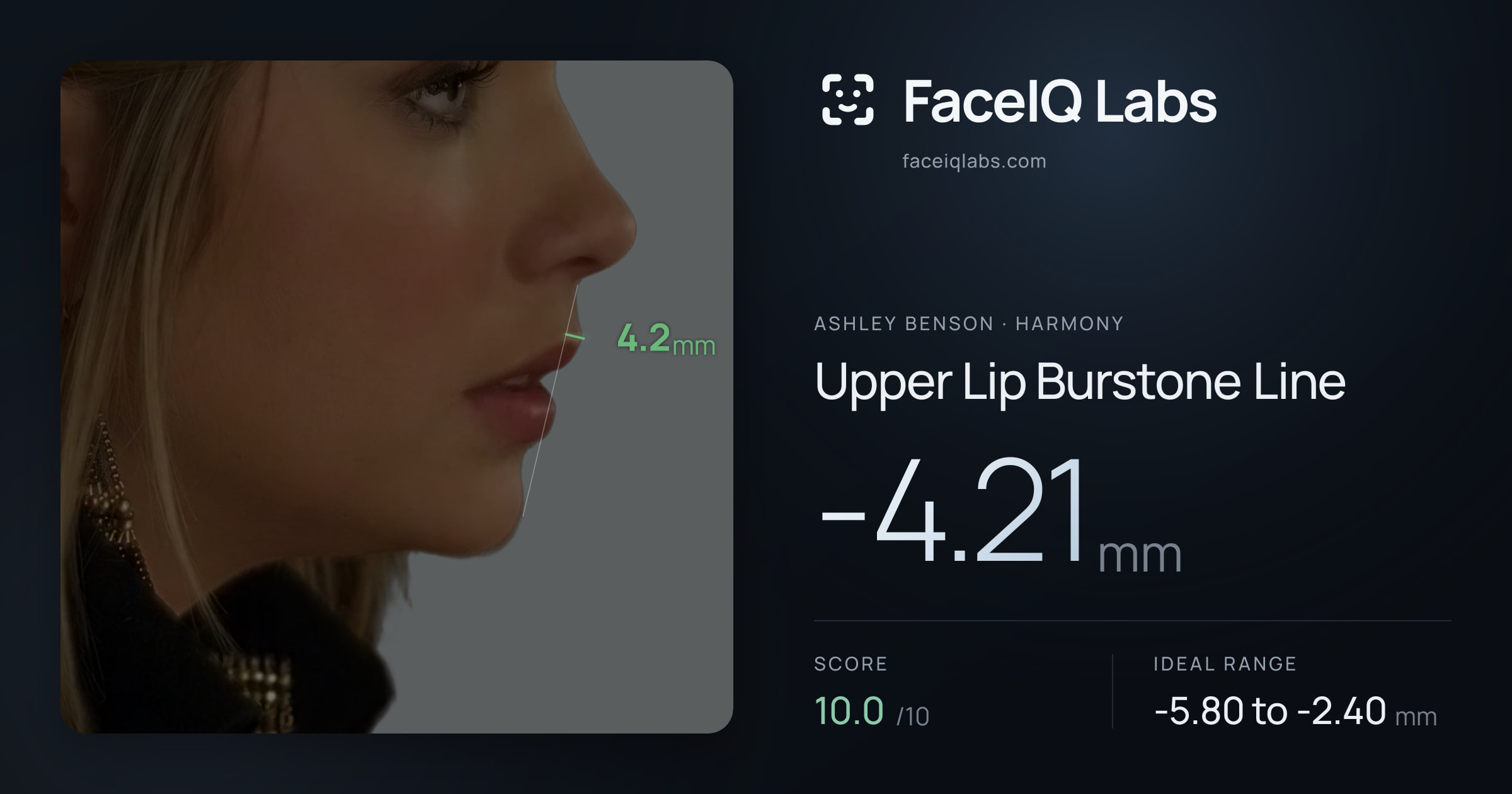 Ashley Benson Upper Lip Burstone Line: -4.21mm, drawn on the photo